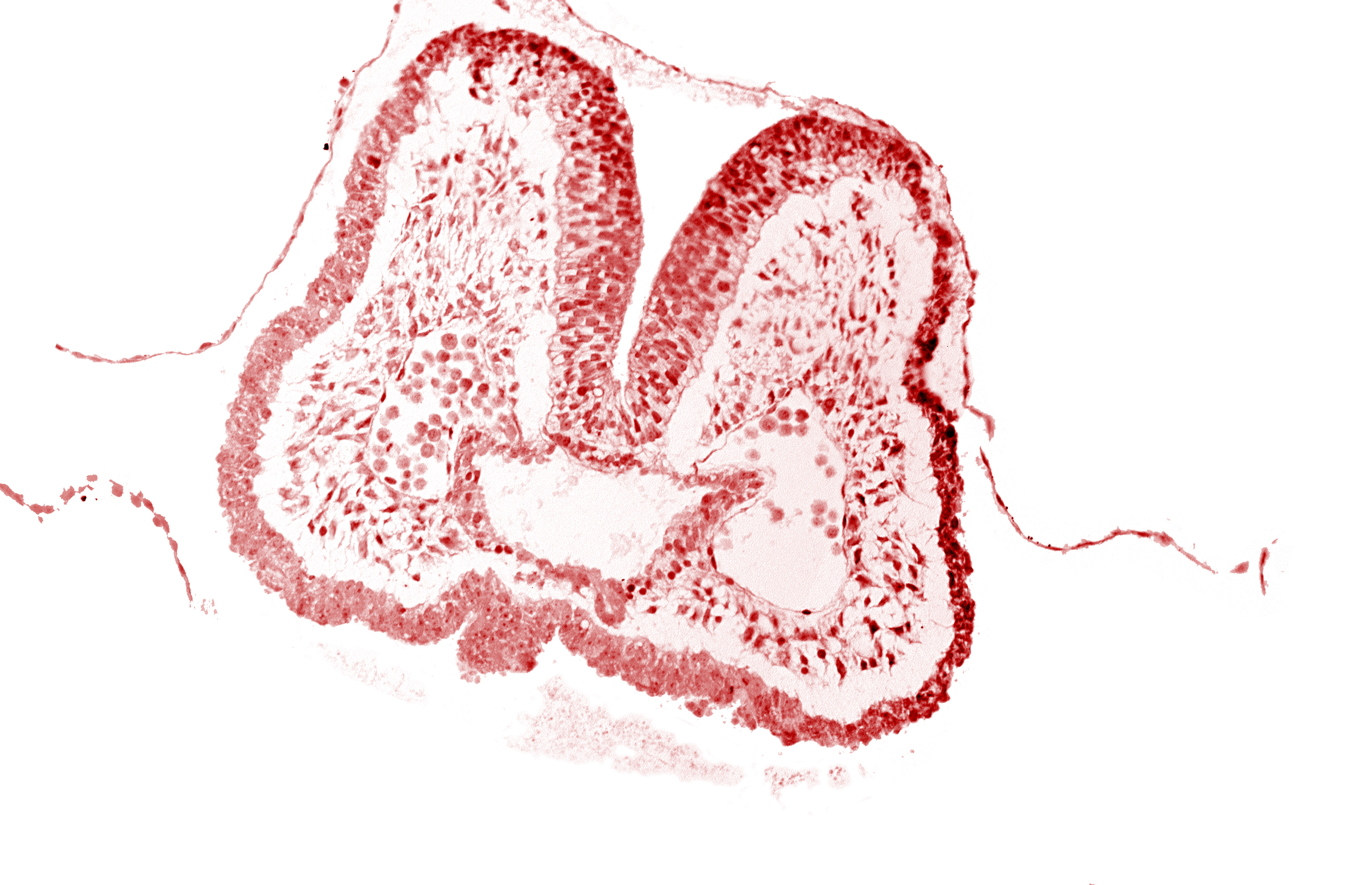 aortic arch 1, artifact space(s), cephalic edge of pharyngeal pouch 1, endoderm, foregut, mandibular prominence of pharyngeal arch 1, mesencephalic neural crest, neural fold [mesencephalon (M)], stomodeum