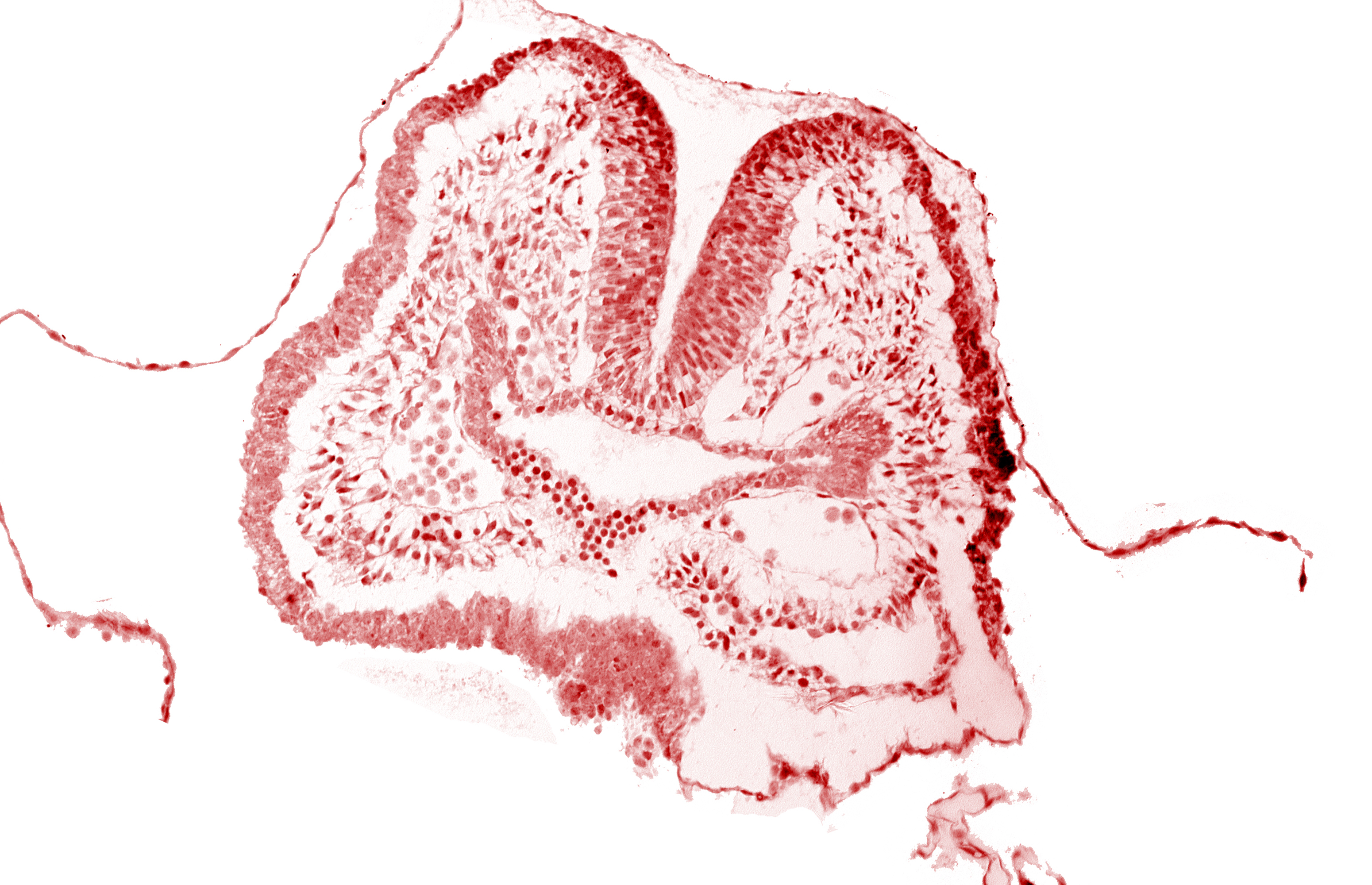 aortic arch 1, cephalic neuropore, dorsal aorta, endoderm, facio-vestibulocochlear neural crest (CN VII and CN VIII), floor of foregut, foregut, neural fold [rhombencephalon (Rh. A)], notochordal plate, pericardial cavity, pharyngeal pouch 1, surface ectoderm