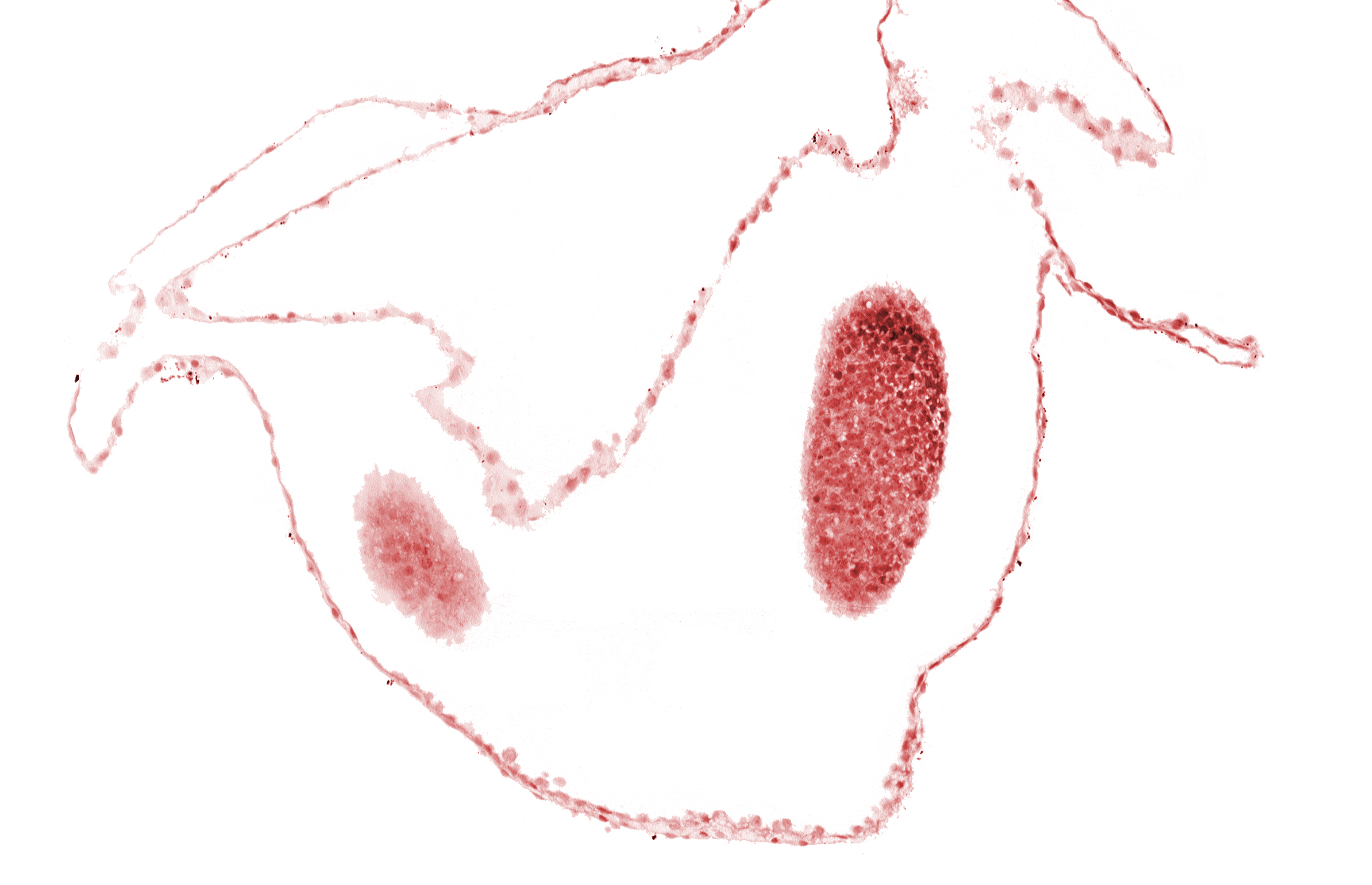 cephalic edge of left neural fold (primordial diencephalon), cephalic part of left neural fold (primordial diencephalon)