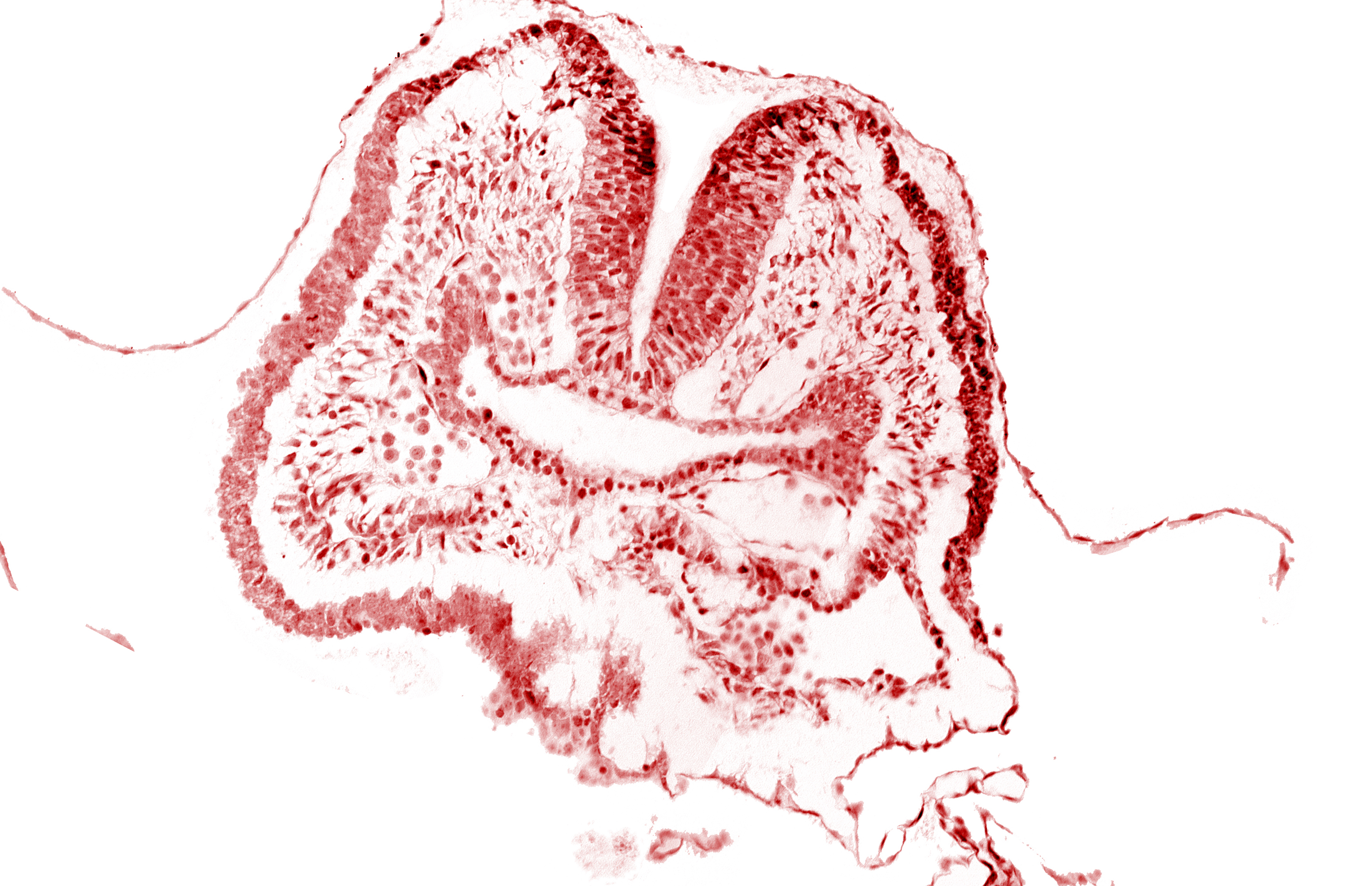 amnion, aortic arch 1, cephalic neuropore, dorsal aorta, endoderm, facio-vestibulocochlear neural crest (CN VII and CN VIII), floor of foregut, head fold region, neural fold [rhombencephalon (Rh. A)], pericardial cavity, pharyngeal pouch 1, surface ectoderm