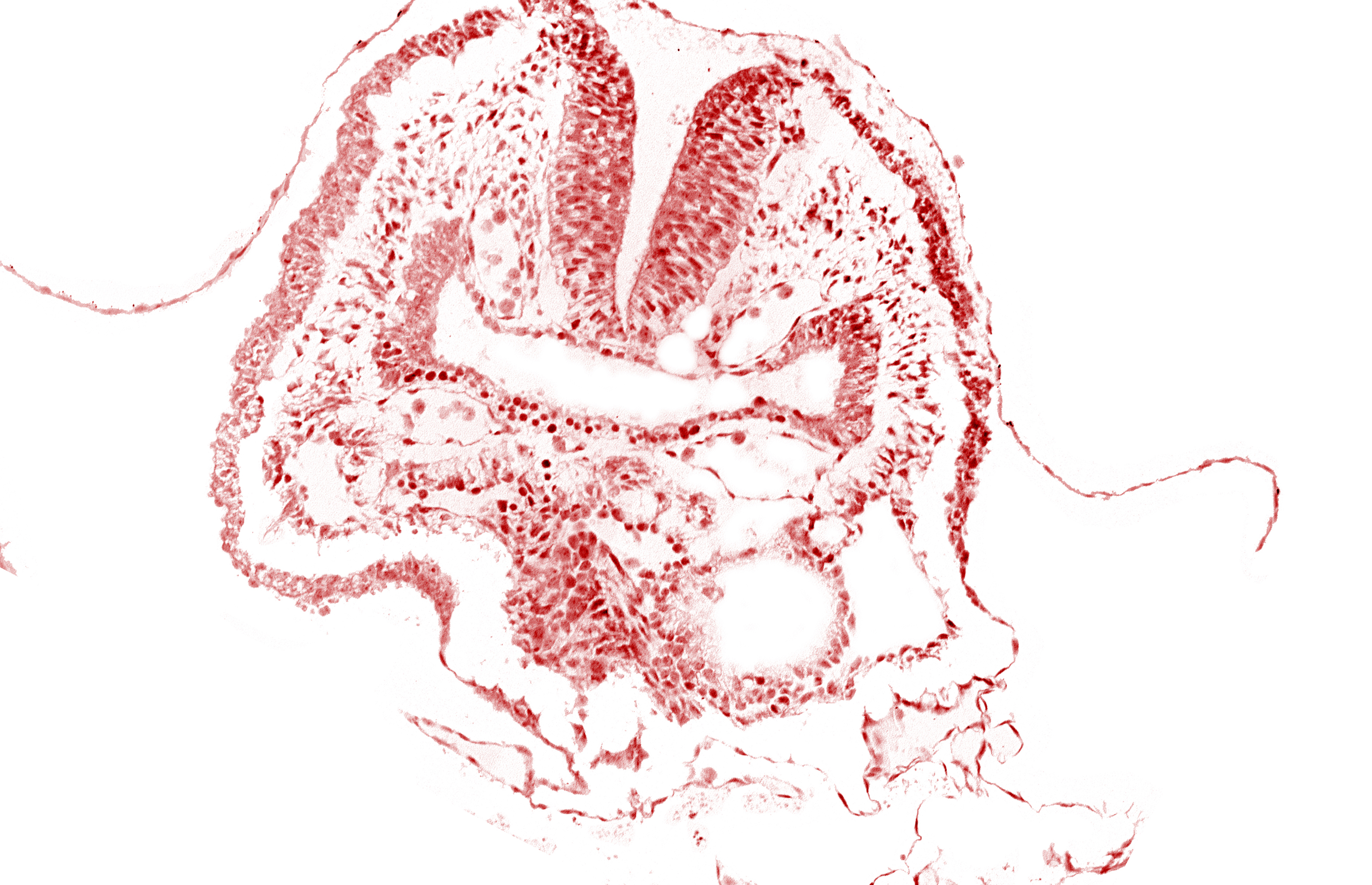 amnion, aortic arch 1, cephalic neuropore, dorsal aorta, facio-vestibulocochlear neural crest (CN VII and CN VIII), head fold region, neural fold [rhombencephalon (Rh. A)], pericardial cavity, pharyngeal pouch 1, pharyngeal pouch 1 endoderm: dorsal part, pharyngeal pouch 1 endoderm: ventral part