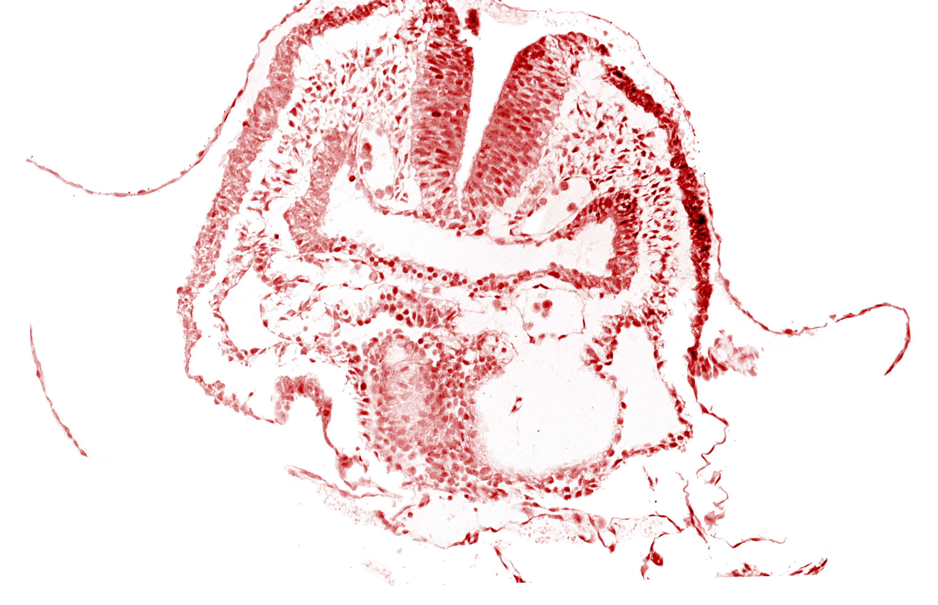 amnion, aortic arch 1, cephalic neuropore, dorsal aorta, facio-vestibulocochlear neural crest (CN VII and CN VIII), head fold region, neural fold [rhombencephalon (Rh. A)], pericardial cavity, pharyngeal pouch 1, pharyngeal pouch 1 endoderm: dorsal part, pharyngeal pouch 1 endoderm: ventral part