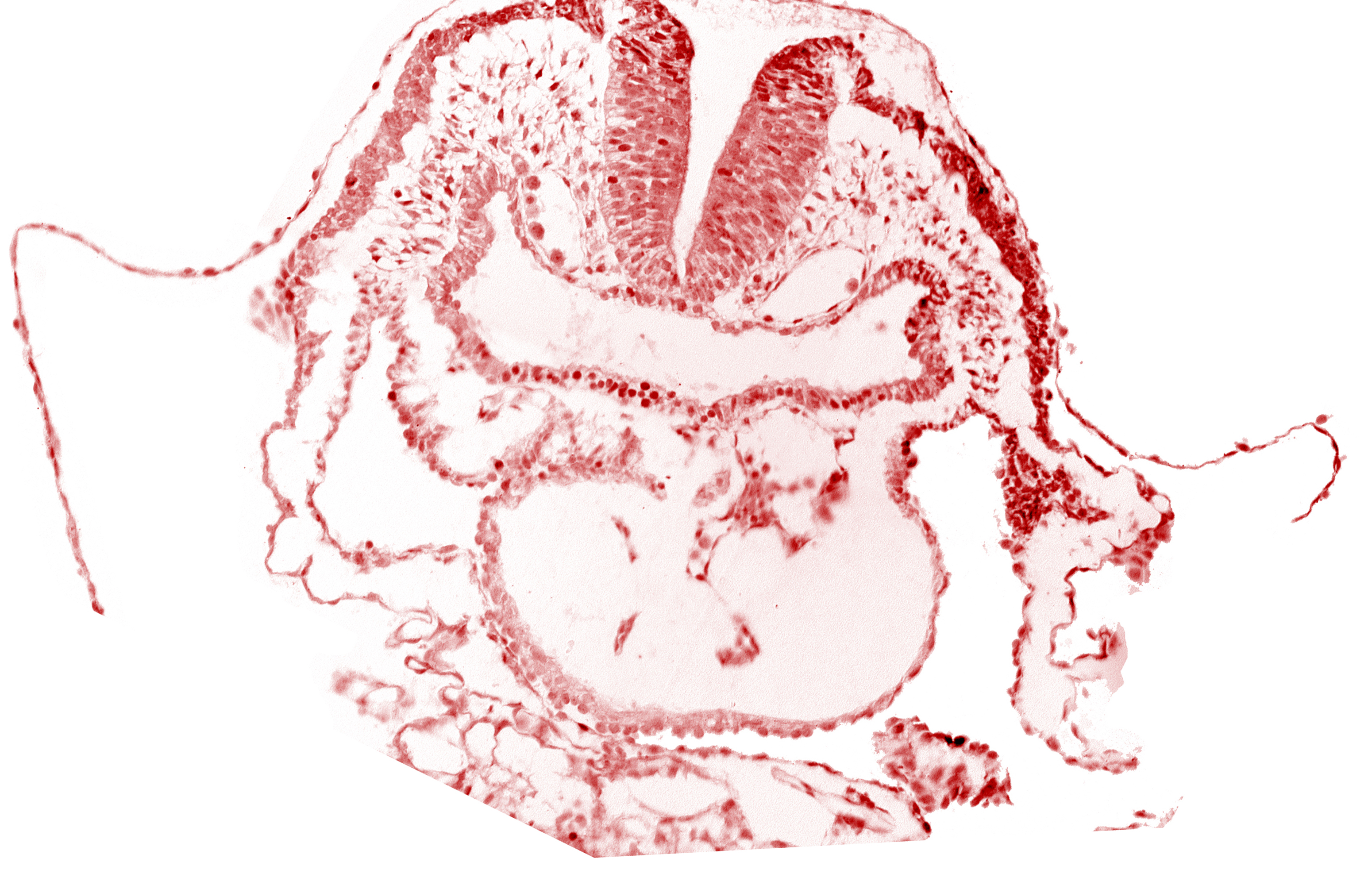 amnion, aortic arch 1, cephalic neuropore, conotruncus, dorsal aorta, head mesenchyme, neural fold [rhombencephalon (Rh. A)], pericardial cavity, pharyngeal pouch 1, pharyngeal pouch 1 endoderm: dorsal part, pharyngeal pouch 1 endoderm: ventral part