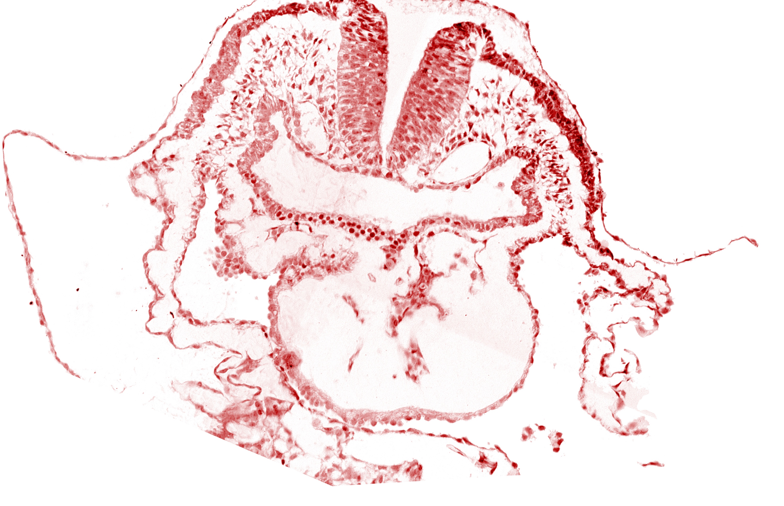 aortic arch 1, cephalic neuropore, conotruncus, dorsal aorta, head fold region, head mesenchyme, neural fold [rhombencephalon (Rh. A)], pericardial cavity, pharyngeal pouch 1, pharyngeal pouch 1 endoderm: dorsal part, pharyngeal pouch 1 endoderm: ventral part