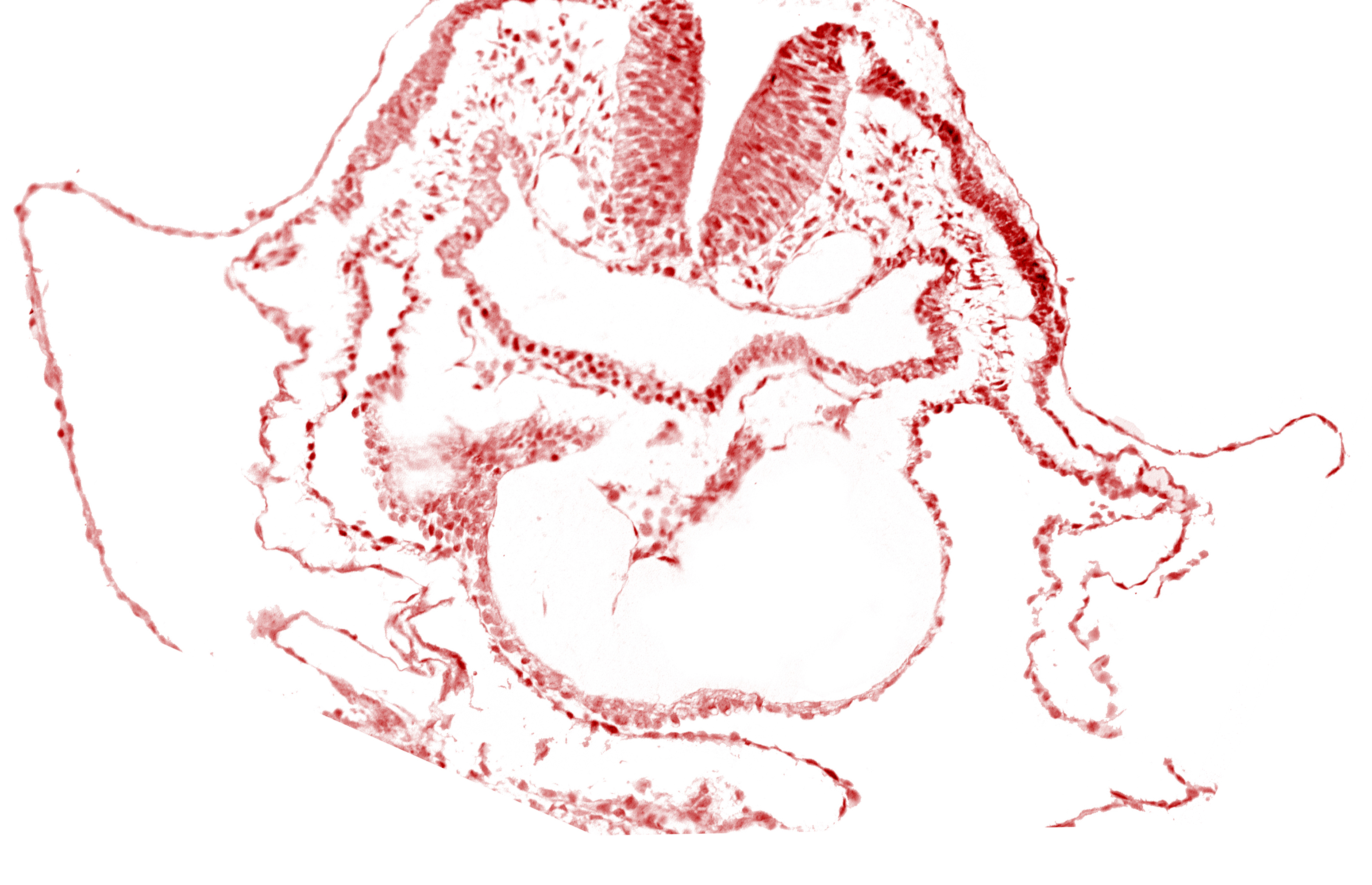 aortic arch 1, cardiac jelly, conotruncus, dorsal aorta, endocardium, head mesenchyme, junction of aortic arch 1 and primordial conotruncus, neural fold [rhombencephalon (Rh. A)], pericardial cavity