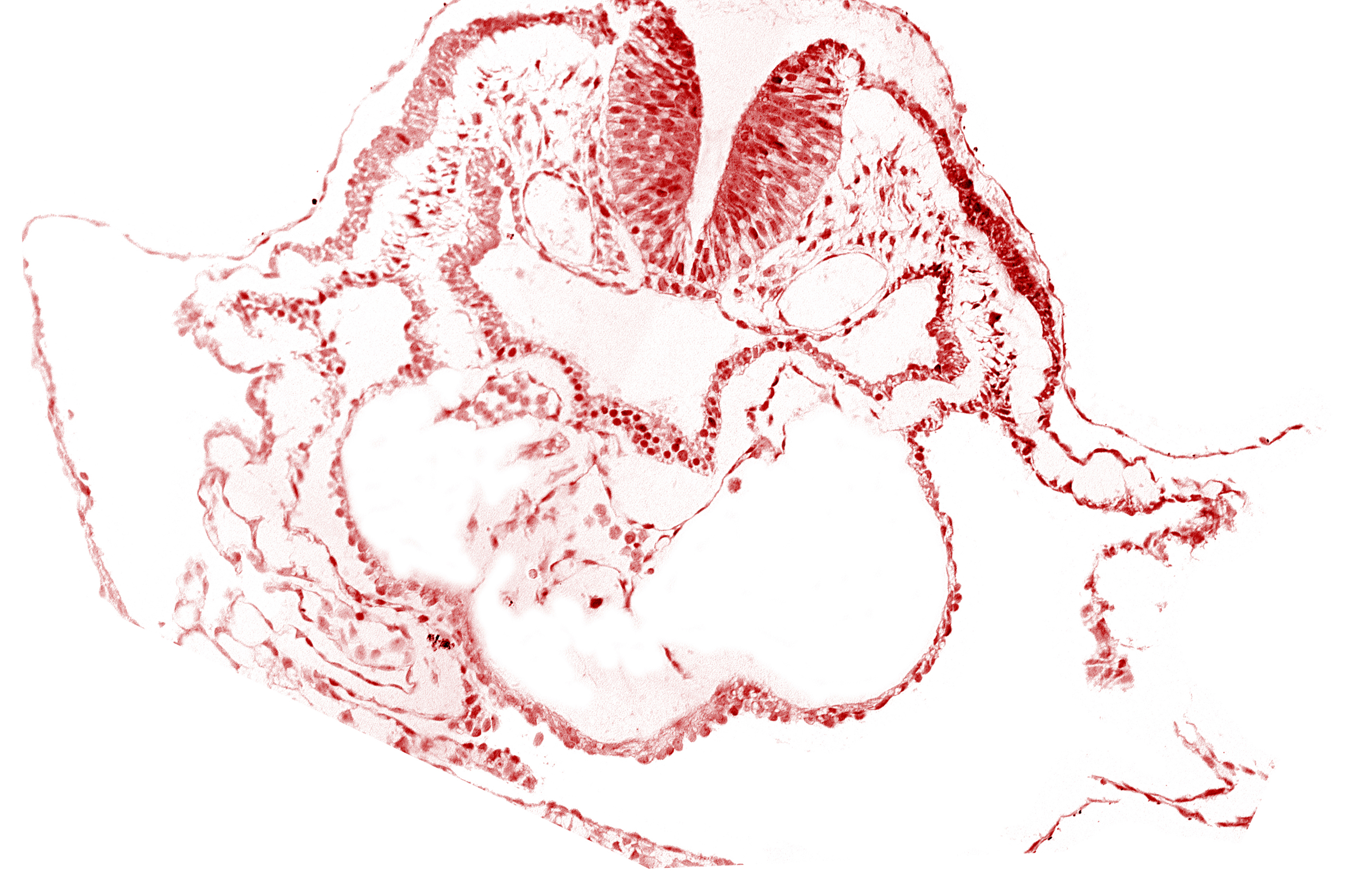 aortic arch 1, cardiac jelly, conotruncus, dorsal aorta, epimyocardium, lateral pharyngeal recess, left bulboventricular sulcus, neural fold [rhombencephalon (Rh. A)], pericardial cavity, thyroid gland primordium