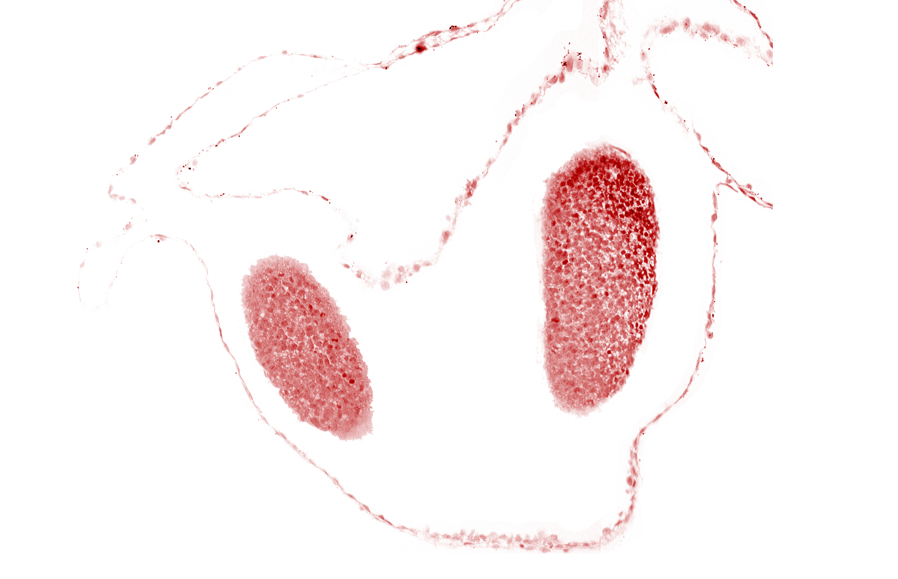 cephalic part of left neural fold (primordial diencephalon), neural fold [primordial diencephalon (D1)], neural fold [primordial diencephalon (D2)]