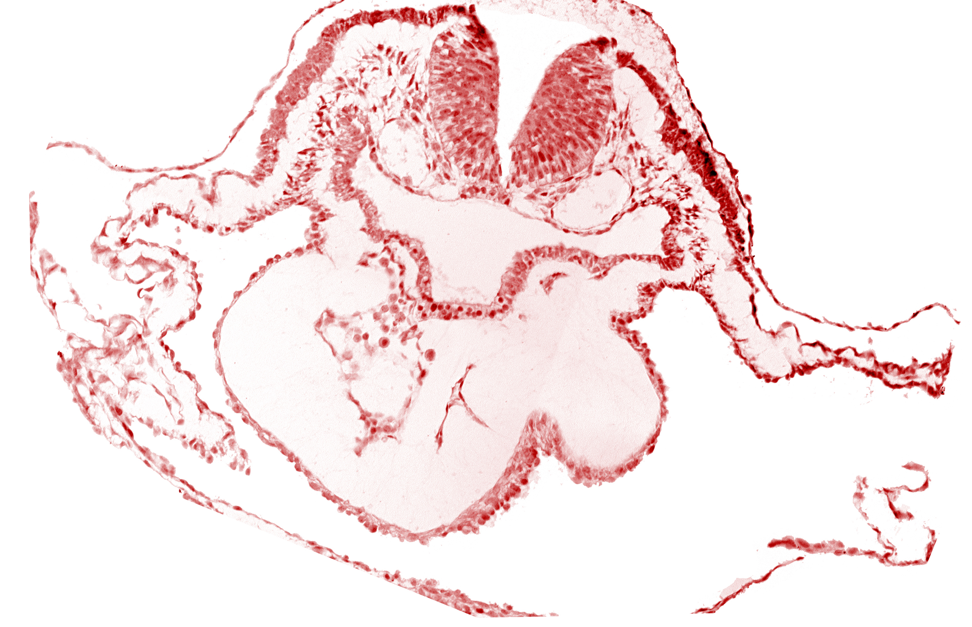 artifact separation(s), bulbis cordis, dorsal aorta, lateral pharyngeal recess, left bulboventricular sulcus, neural fold [rhombencephalon (Rh. B)], notochordal plate, pericardial cavity