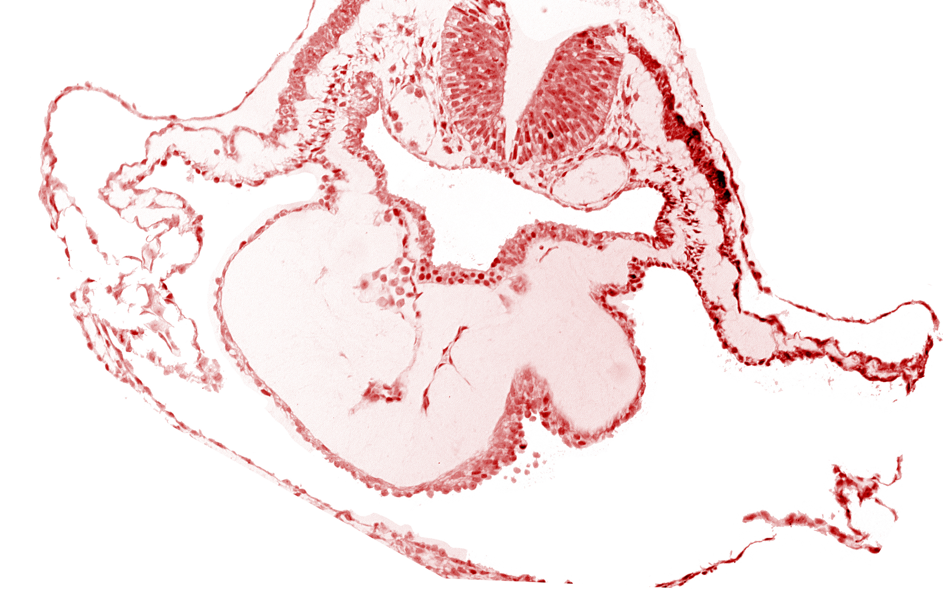 artifact separation(s), bulbis cordis, dorsal aorta, lateral pharyngeal recess, left bulboventricular sulcus, neural fold [rhombencephalon (Rh. B)], notochordal plate, pericardial cavity, presumptive right ventricle