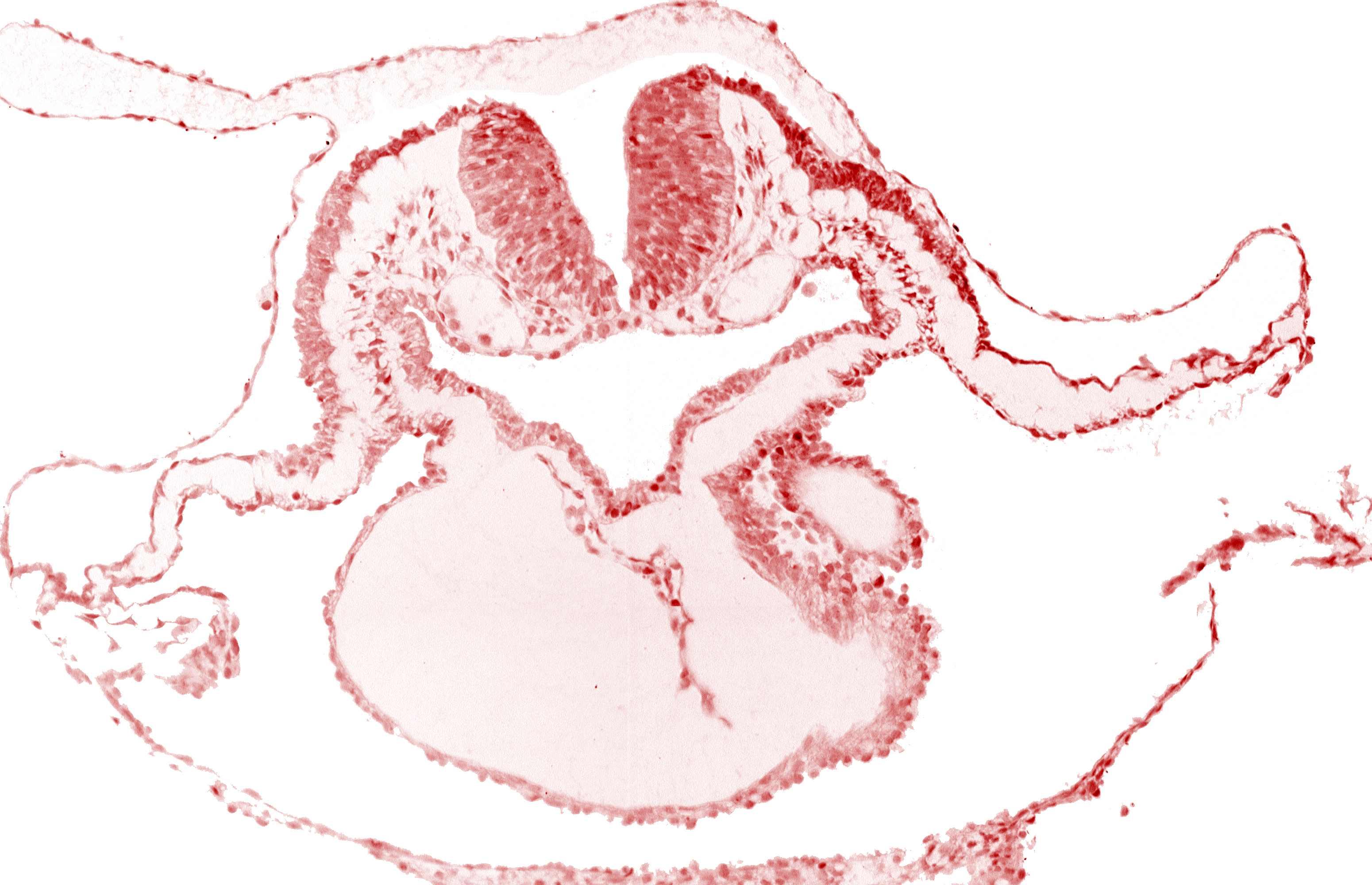 alar plate(s), artifact separation(s), basal plate, bulbis cordis, lateral pharyngeal recess, left bulboventricular sulcus, looped heart, neural fold [rhombencephalon (Rh. B)], notochordal plate, pericardial cavity, presumptive left ventricle, presumptive right ventricle, sulcus limitans
