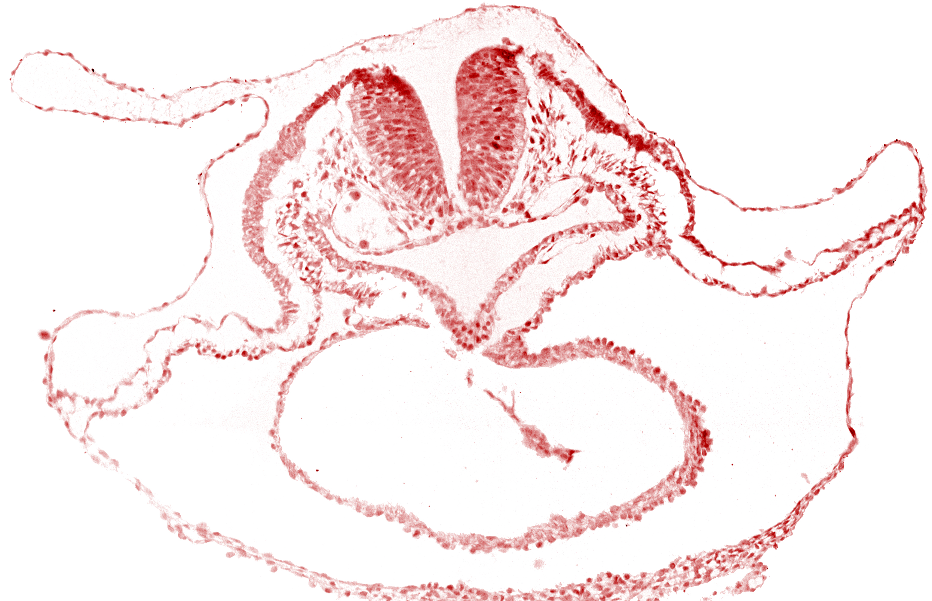 bulbis cordis, cardiac jelly, cephalic neuropore, dorsal aorta, lateral pharyngeal recess, median pharyngeal groove, neural fold [rhombencephalon (Rh. B)], pericardial cavity, presumptive left ventricle