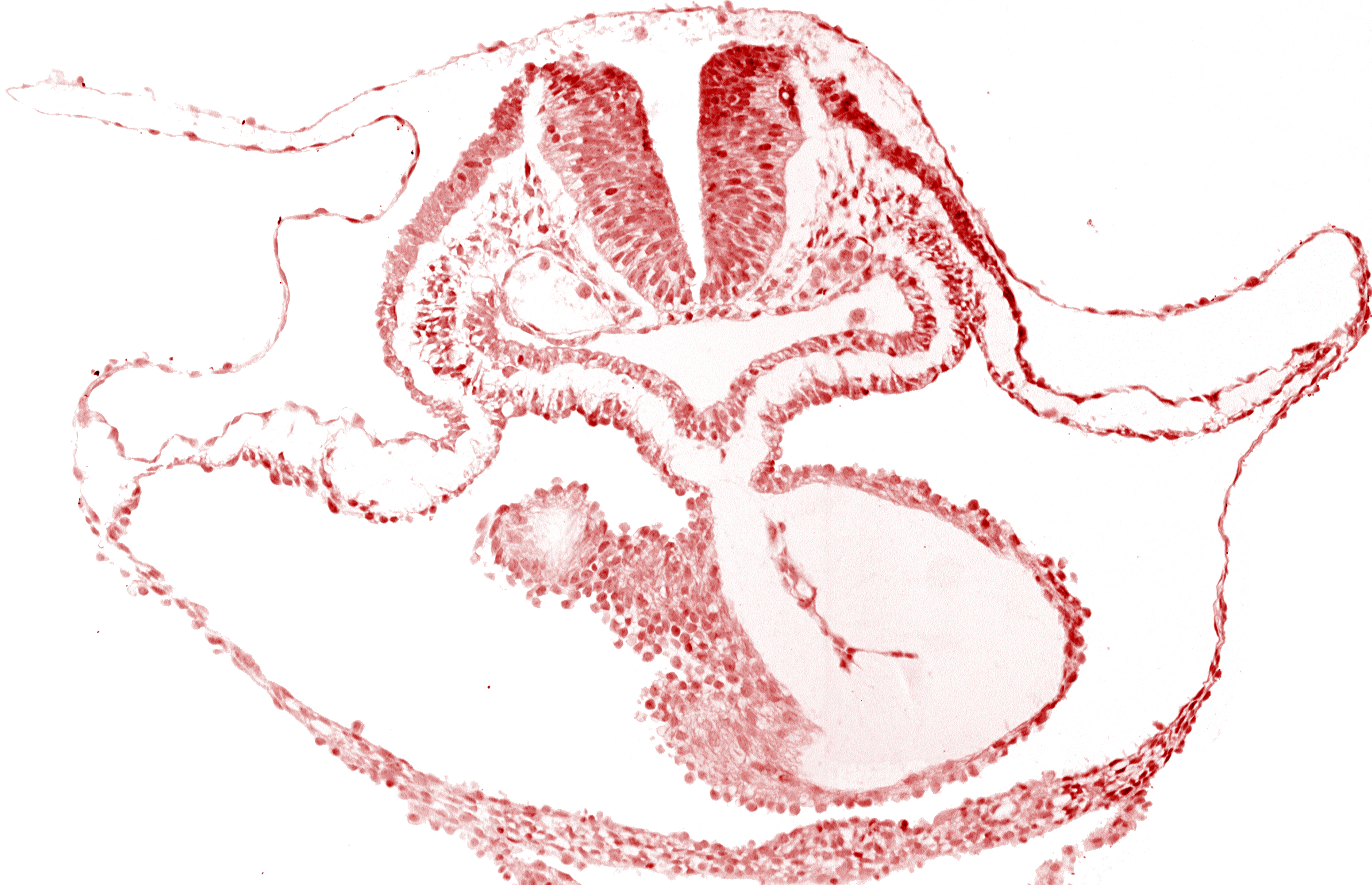 cephalic neuropore, epimyocardium, laryngotracheal sulcus, lateral pharyngeal recess, mesocardium, neural fold [rhombencephalon (Rh. B)], notochordal plate, otic placode, pericardial cavity, presumptive left ventricle