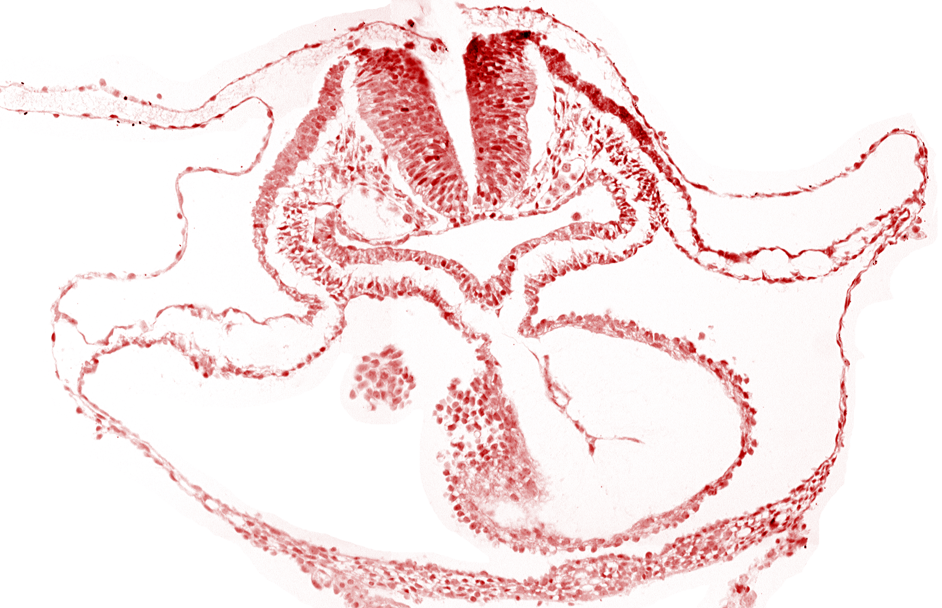 cephalic neuropore, epimyocardium, laryngotracheal sulcus, lateral pharyngeal recess, looped heart, mesocardium, neural fold [rhombencephalon (Rh. B)], notochordal plate, otic placode, pericardial cavity, pericardial sac, presumptive left ventricle