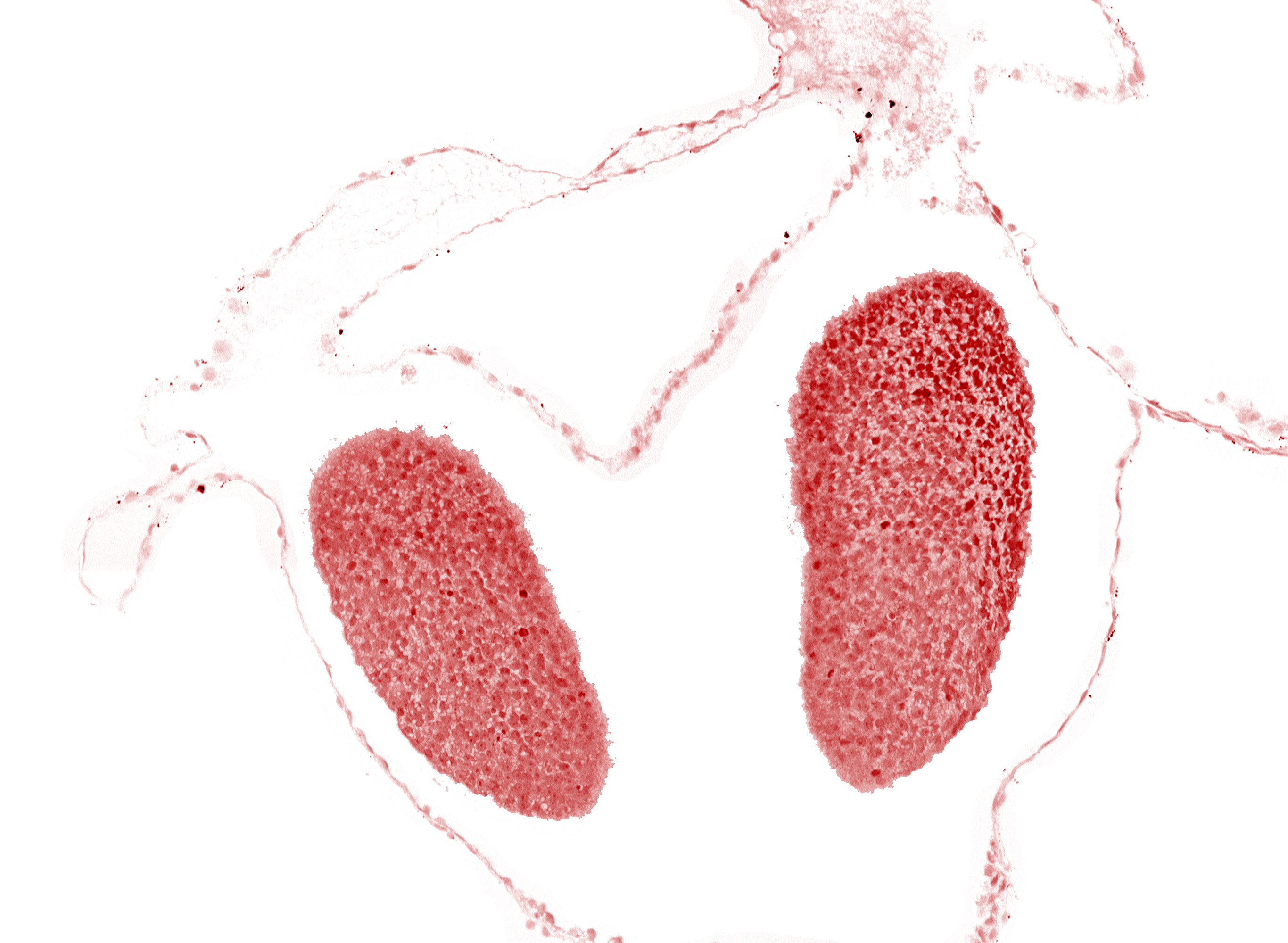 neural fold [primordial diencephalon (D1)], neural fold [primordial diencephalon (D2)]