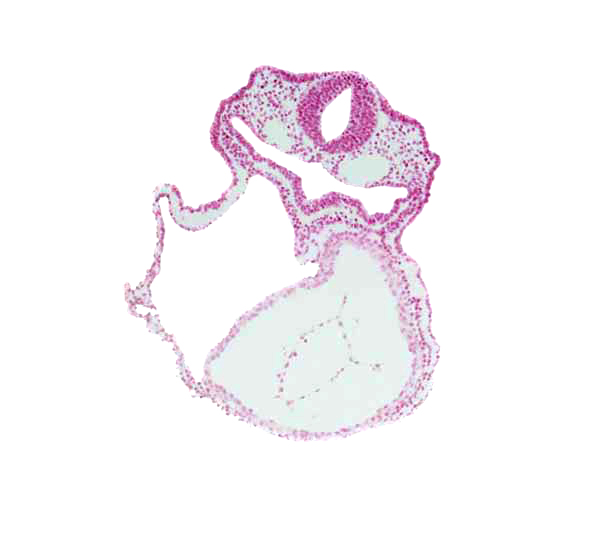 amnion attachment, dorsal aorta, edge of atrioventricular canal, endoderm, left ventricle, otic placode, pericardial cavity, respiratory primordium, rhombencephalon (Rh. 5), surface ectoderm