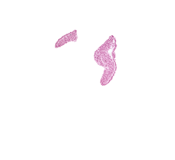 artifact space(s), cephalic edge of right neural fold [diencephalon (D1)], cephalic edge of right neural fold [diencephalon (D2)], head mesenchyme, junction of neural ectoderm and surface ectoderm, neural fold [diencephalon (D1)], neural fold [diencephalon (D2)], optic sulcus, surface ectoderm