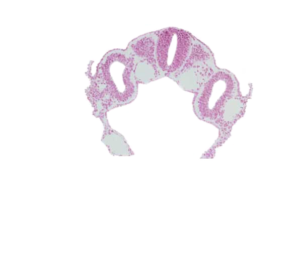 amnion attachment, caudal edge of dermatomyotome 3 (O-3), dorsal aorta, endoderm, hypoglossal neural crest (CN XII), left horn of sinus venosus, midgut, notochord, peritoneal cavity (coelom), rhombencephalon (Rh. D), umbilical vesicle wall, vitelline (omphalomesenteric) vein