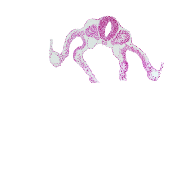 alar plate(s), basal plate, communication between peritoneal cavity and extra-embryonic coelom, dermatomyotome 8 (C-4), left umbilical vein, midgut, notochord, sclerotome, somatopleuric mesoderm, spinal part of neural tube, splanchnopleuric mesoderm, sulcus limitans, umbilical vesicle wall