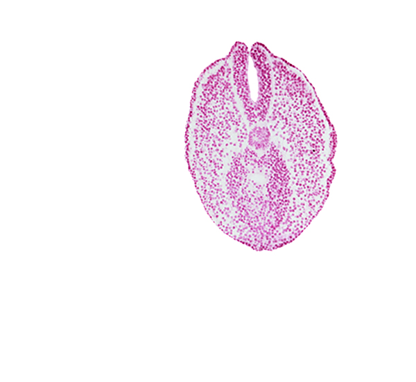 caudal edge of hindgut lumen, lateral mesoderm, notochord, paraxial mesoderm, tangentially cut endoderm