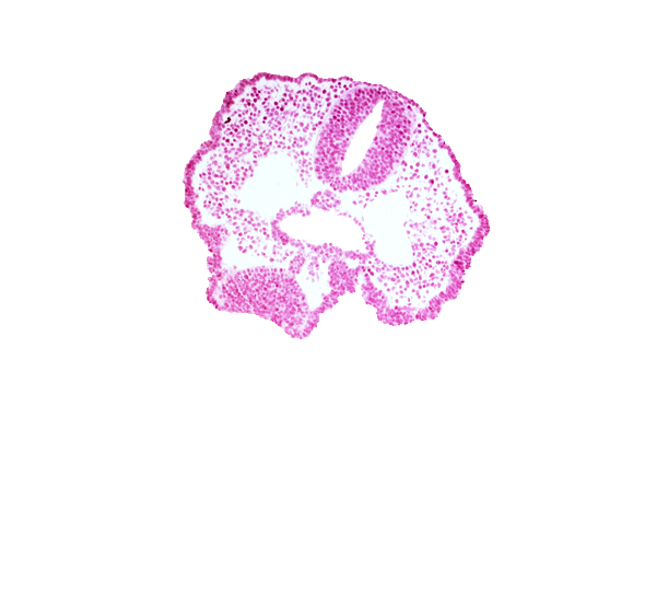 adenohypophysis, cephalic part of foregut lumen, endoderm, junction of aortic arch 1 and dorsal aorta, junction of neural ectoderm and surface ectoderm, maxillary prominence of pharyngeal arch 1, neural fold [telencephalon medium (T)], notochord, rhombencephalon (Rh. 2), stomodeum