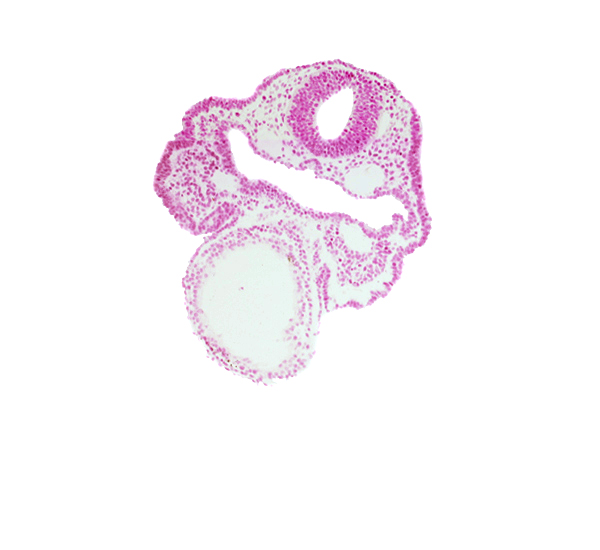 aortic arch 1, cardiac jelly, dorsal aorta, epimyocardium, facio-vestibulocochlear neural crest (CN VII and CN VIII), notochordal plate, primary head vein, rhombencephalon (Rh. 4), surface ectoderm