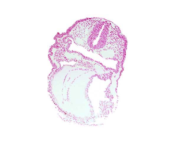 aortic arch 1, aortic sac, cardiac jelly, conotruncus, dorsal aorta, endocardium, epimyocardium, junction of aortic arch 1 and aortic sac, notochordal plate, otic placode, pericardial cavity, right ventricle