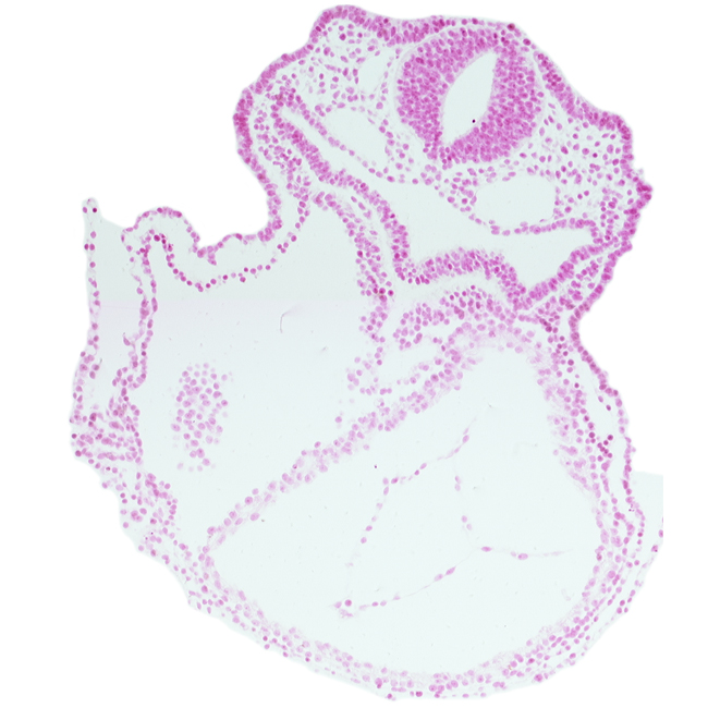 amnion attachment, caudal edge of right ventricle, cephalic edge of atrioventricular canal, dorsal aorta, foregut, laryngotracheal groove, lateral pharyngeal recess, left ventricle, mesocardium, otic placode, rhombencephalon (Rh. 5)