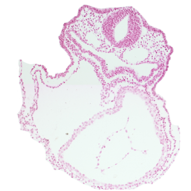 amnion attachment, dorsal aorta, edge of atrioventricular canal, endoderm, left ventricle, otic placode, pericardial cavity, respiratory primordium, rhombencephalon (Rh. 5), surface ectoderm
