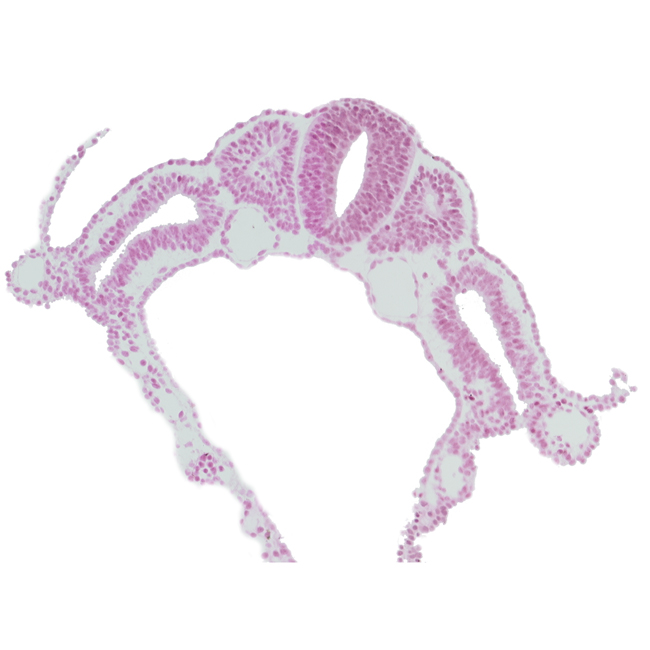 dermatomyotome 6 (C-2), dorsal aorta, lateral body fold, left umbilical vein, midgut, notochord, peritoneal cavity (coelom), right umbilical vein, spinal part of neural tube, umbilical vesicle wall