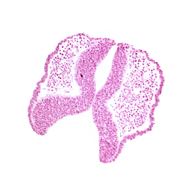 caudal edge of cephalic neuropore, internal carotid artery, neural fold [diencephalon (D1)], neural fold [diencephalon (D2)], neural fold [mesencephalon (M)], neural groove, optic nerve primordium (CN II) [diencephalon (D1)], primordial blood vessel(s)