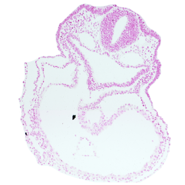 cardiac jelly, caudal part of thyroid diverticulum, dorsal aorta, endoderm, lateral pharyngeal recess, otic placode, pericardial cavity, rhombencephalon (Rh. 5), right ventricle