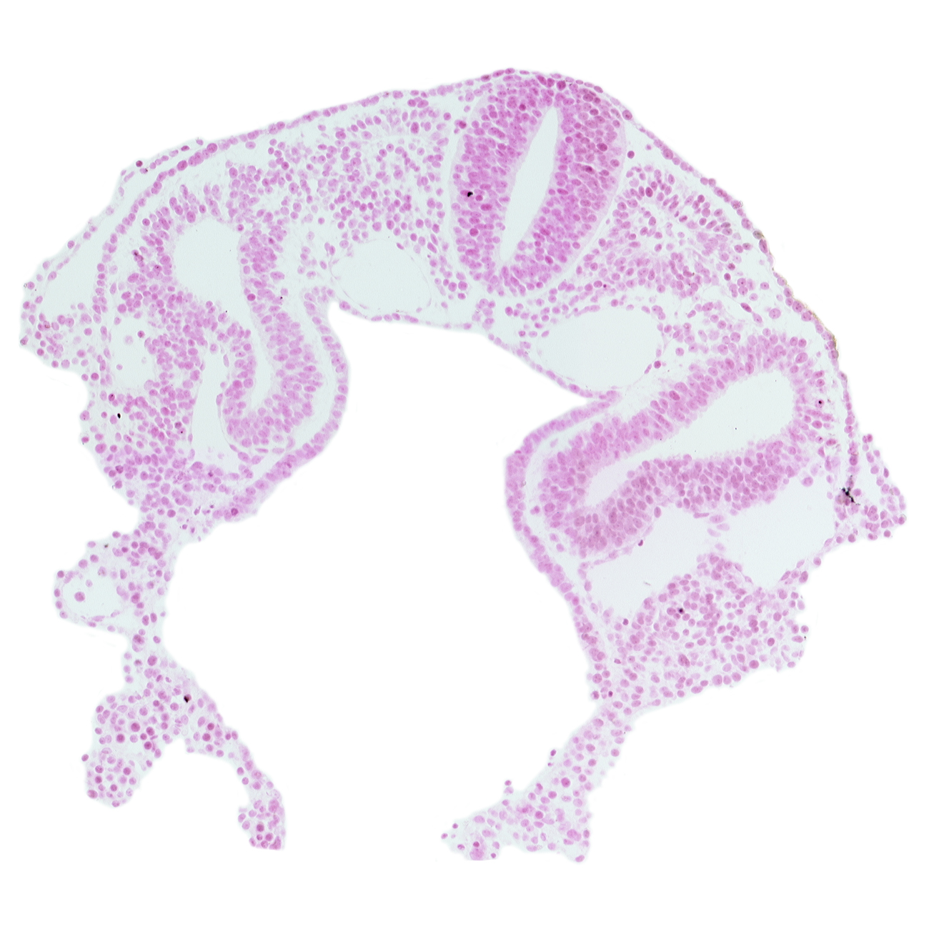 dermatomyotome 2 (O-2) , dorsal aorta, left horn of sinus venosus, midgut, notochord, peritoneal cavity (coelom), rhombencephalon (Rh. D), somitocoel 2, umbilical vesicle wall