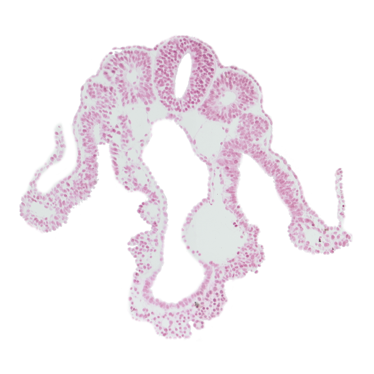 amnion attachment, midgut, somite 10 (C-6), somitocoel 10, spinal part of neural tube
