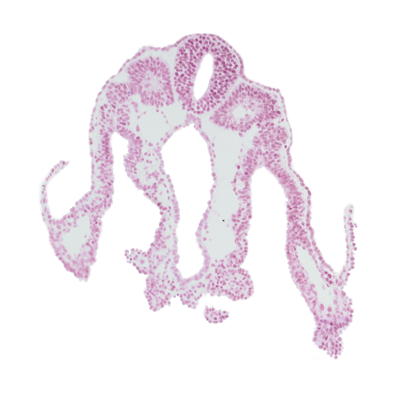 caudal part of umbilical vesicle cavity, dorsal aorta, extra-embryonic ectoderm, extra-embryonic endoderm, extra-embryonic mesoderm, hindgut, lateral body fold, notochord, right umbilical vein, somite 11 (C-7), somitocoel 11