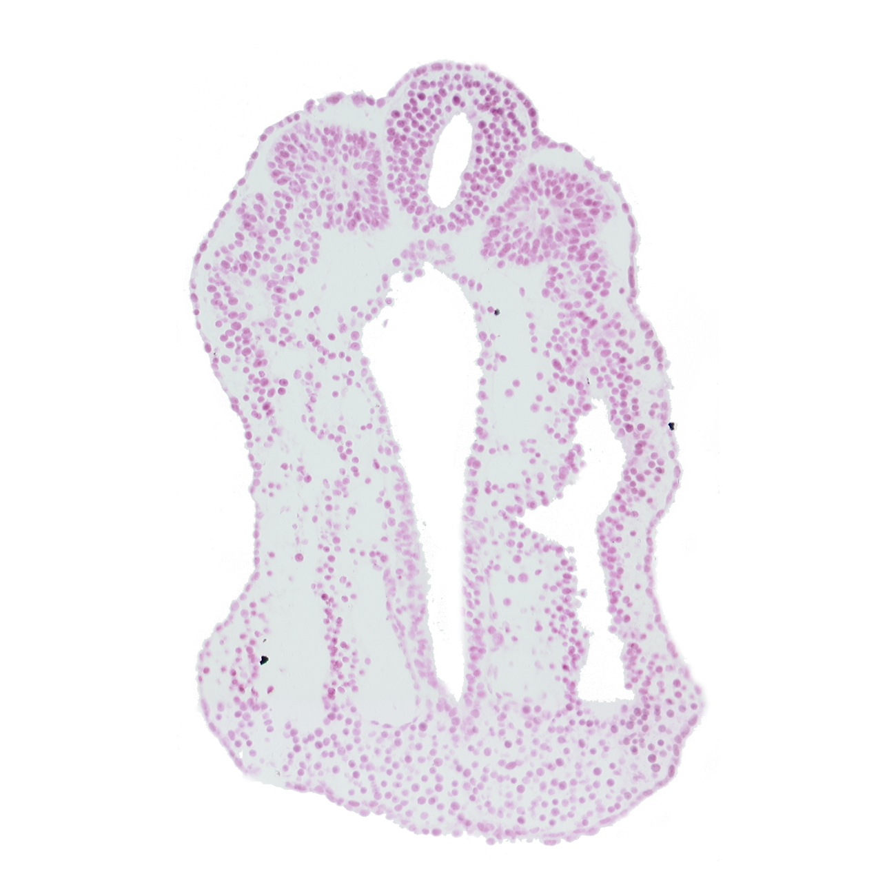 dorsal aorta, intermediate mesenchyme, neural tube, right umbilical artery, somite 13 (T-1), somitocoel 13