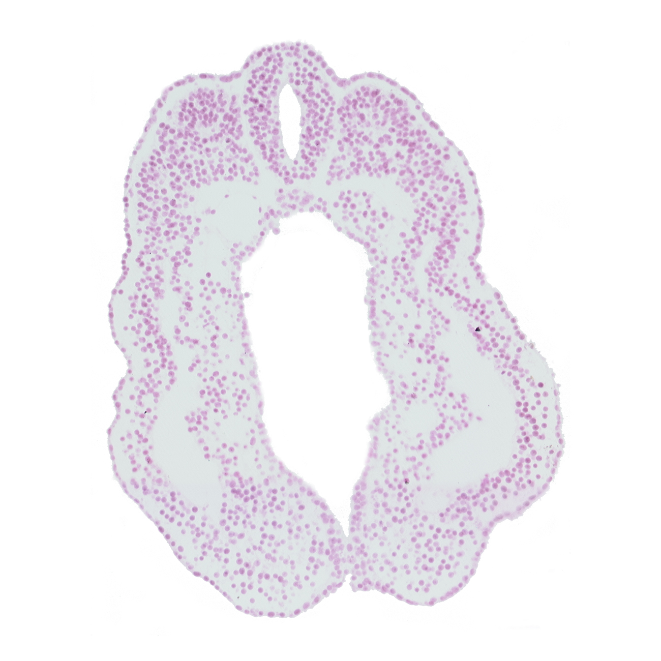 caudal part of peritoneal cavity (coelom), cloacal membrane, cloacal part of hindgut, dorsal aorta, dorsal aorta plexus