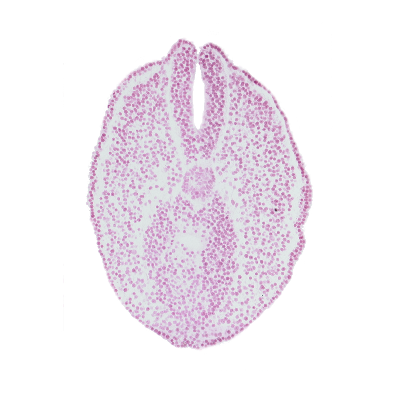 caudal edge of hindgut lumen, lateral mesoderm, notochord, paraxial mesoderm, tangentially cut endoderm