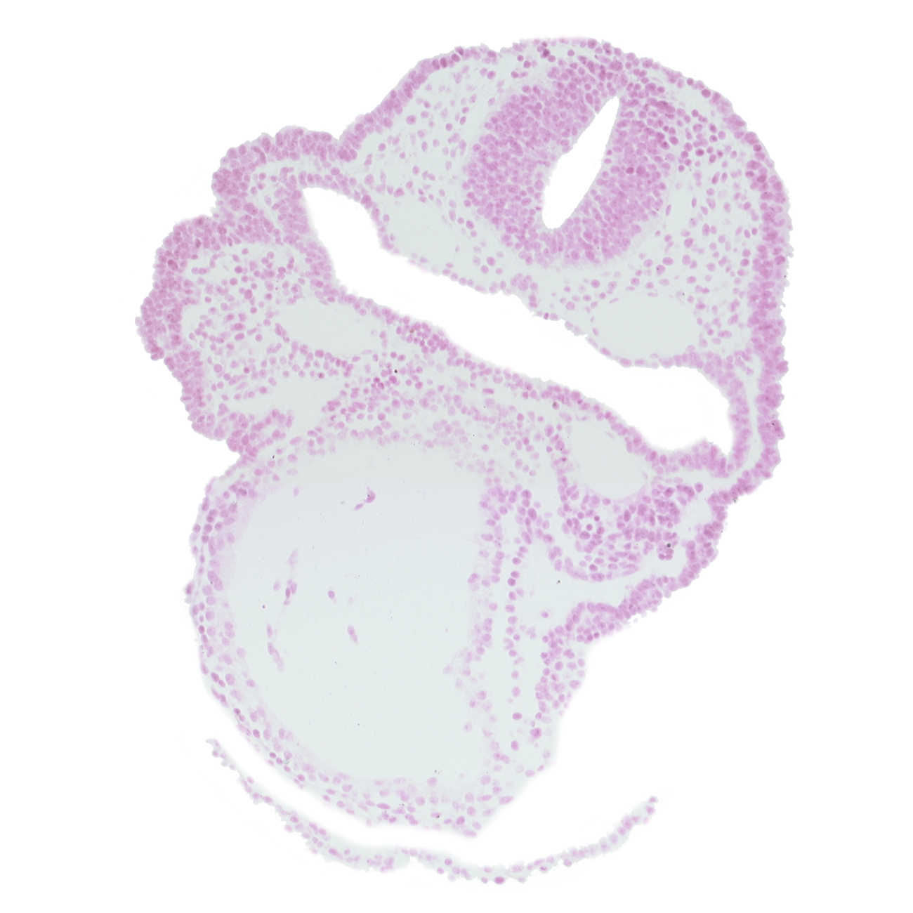 amnion, aortic arch 1, dorsal aorta, ectodermal ring, endocardium, epimyocardium, facio-vestibulocochlear neural crest (CN VII and CN VIII), mandibular prominence of pharyngeal arch 1, mesenchyme, notochordal plate, pericardial cavity, primary head vein, rhombencephalon (Rh. 4), surface ectoderm