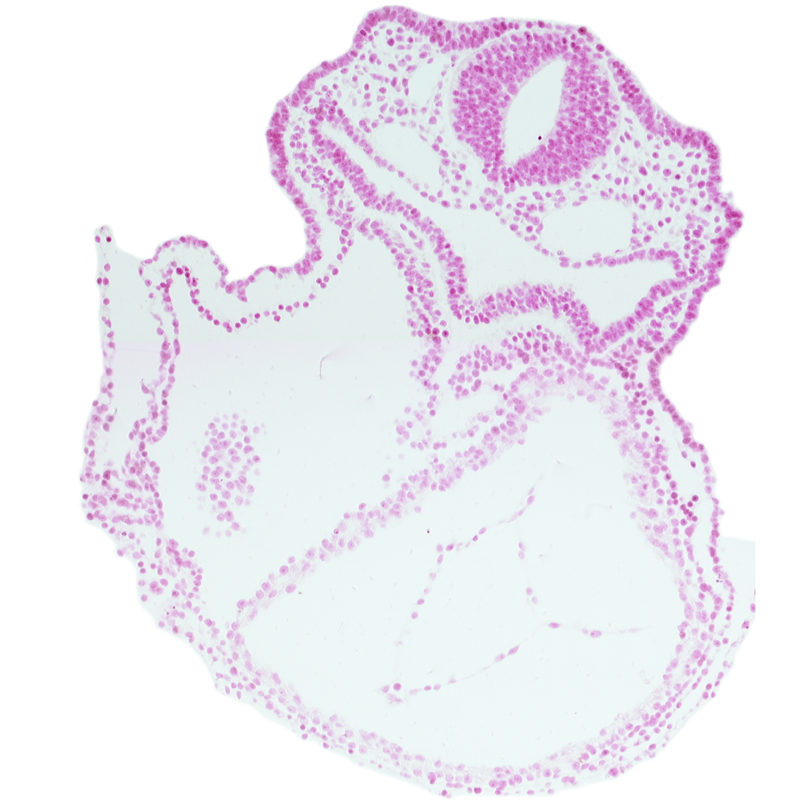 amnion attachment, caudal edge of right ventricle, cephalic edge of atrioventricular canal, dorsal aorta, foregut, laryngotracheal groove, lateral pharyngeal recess, left ventricle, mesocardium, otic placode, rhombencephalon (Rh. 5)