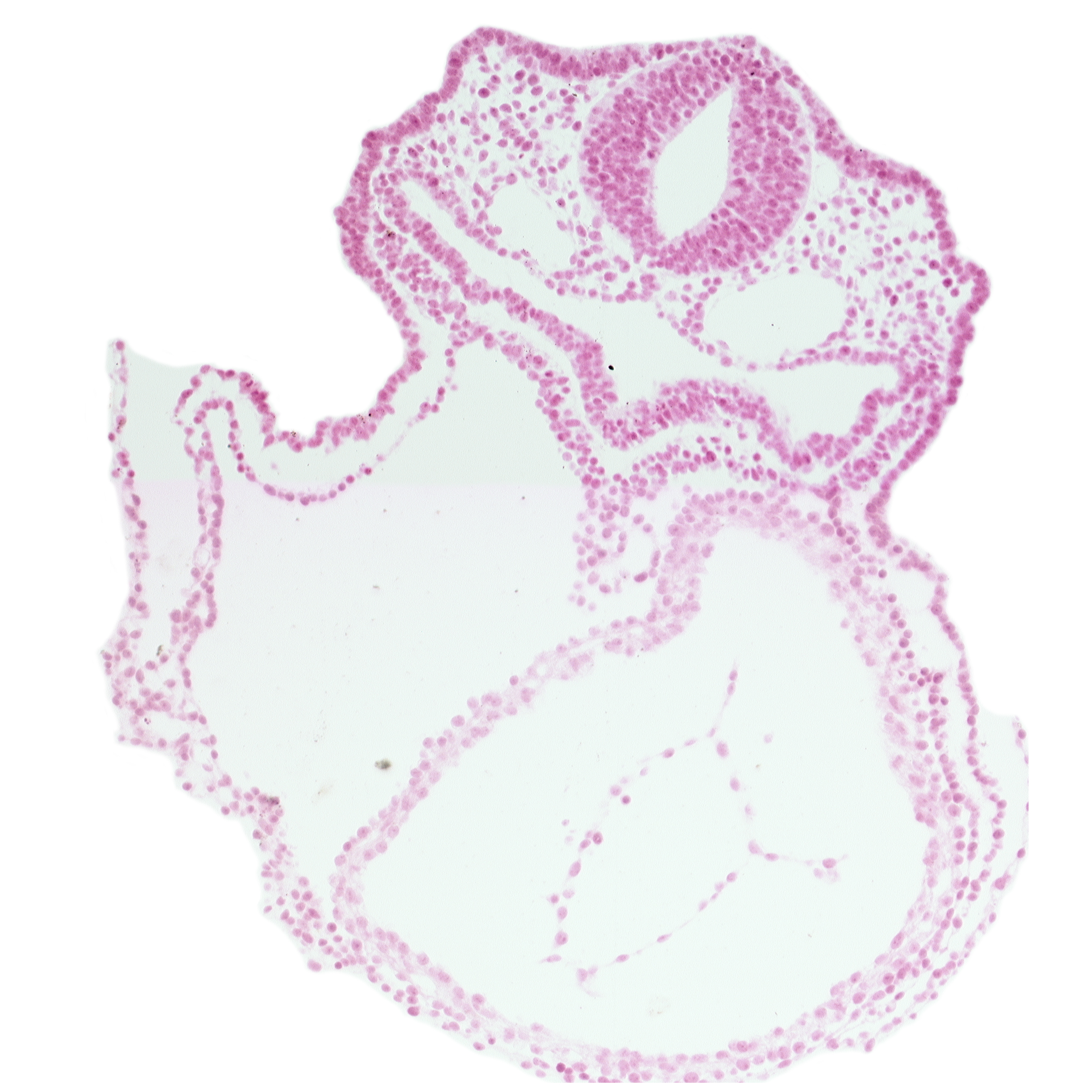 amnion attachment, dorsal aorta, edge of atrioventricular canal, endoderm, left ventricle, otic placode, pericardial cavity, respiratory primordium, rhombencephalon (Rh. 5), surface ectoderm