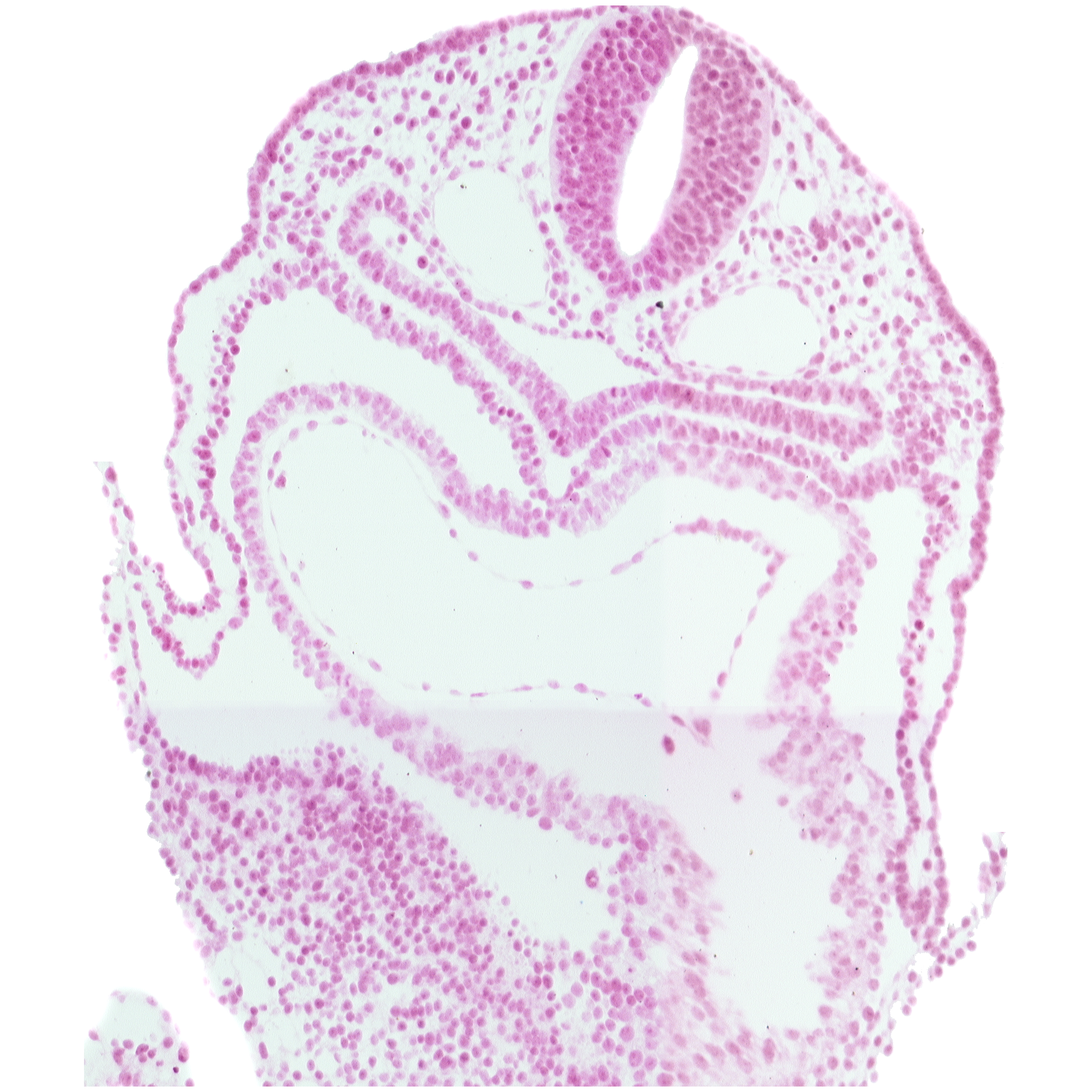 amnion attachment, cardiac jelly, dorsal aorta, epimyocardium, foregut lumen, interatrial foramen (primum), left atrium, pericardial cavity, precardinal vein, right atrium, septum transversum, umbilical vesicle wall