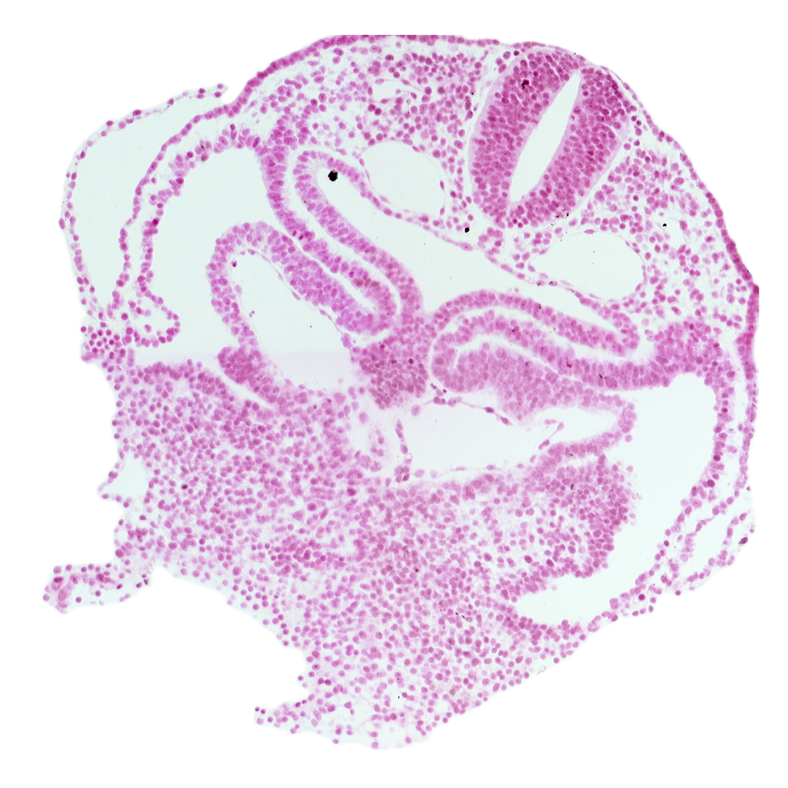 amnion attachment, cephalic edge of dermatomyotome 1 (O-1), course of common cardinal vein, hepatic plate, hypoglossal neural crest (CN XII), left horn of sinus venosus, pericardial cavity, precardinal vein, rhombencephalon (Rh. D), right horn of sinus venosus, septum transversum, umbilical vesicle wall