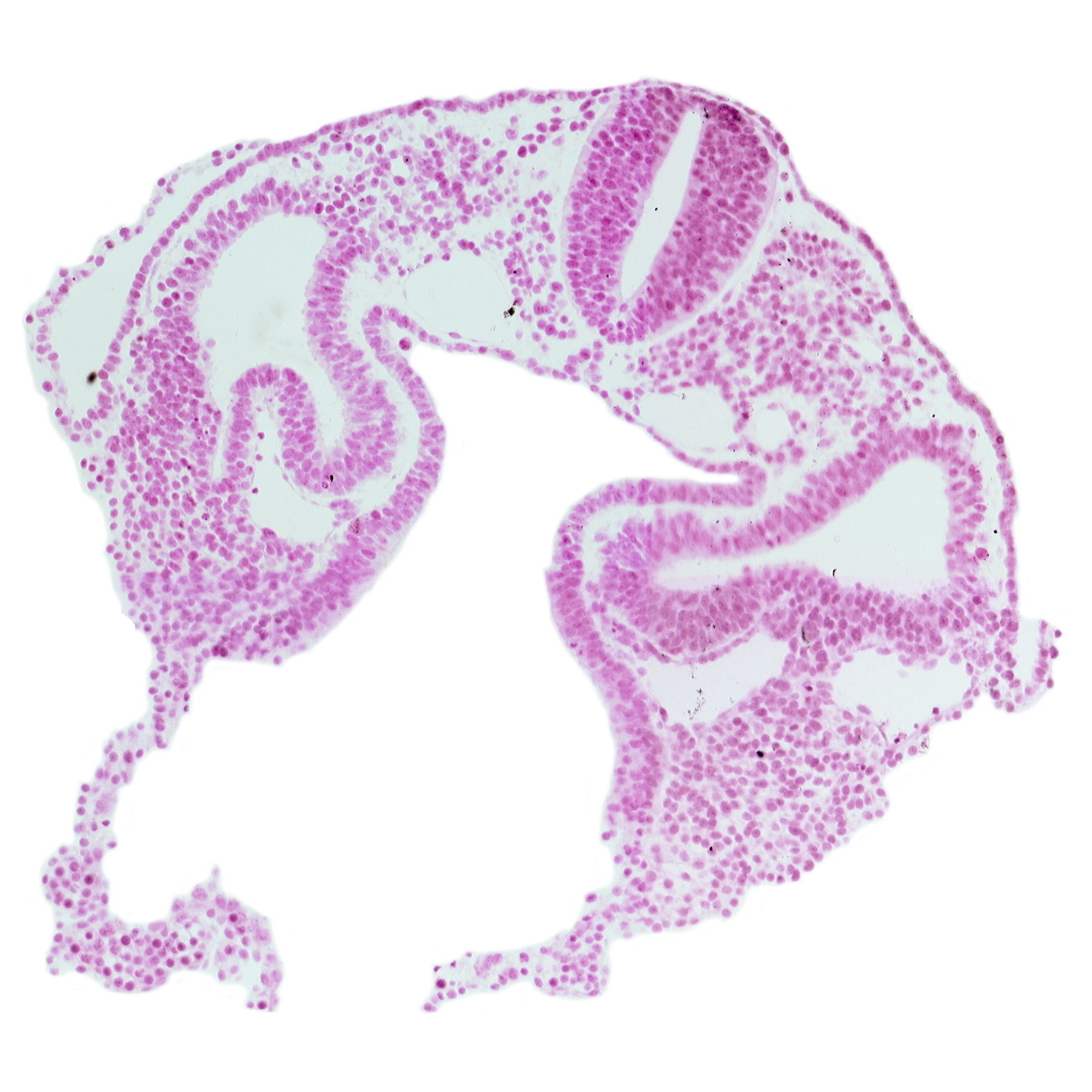 amnion attachment, dermatomyotome 2 (O-2) , left horn of sinus venosus, midgut, notochord, peritoneal cavity (coelom), postcardinal vein, rhombencephalon (Rh. D), sclerotome, umbilical vesicle wall