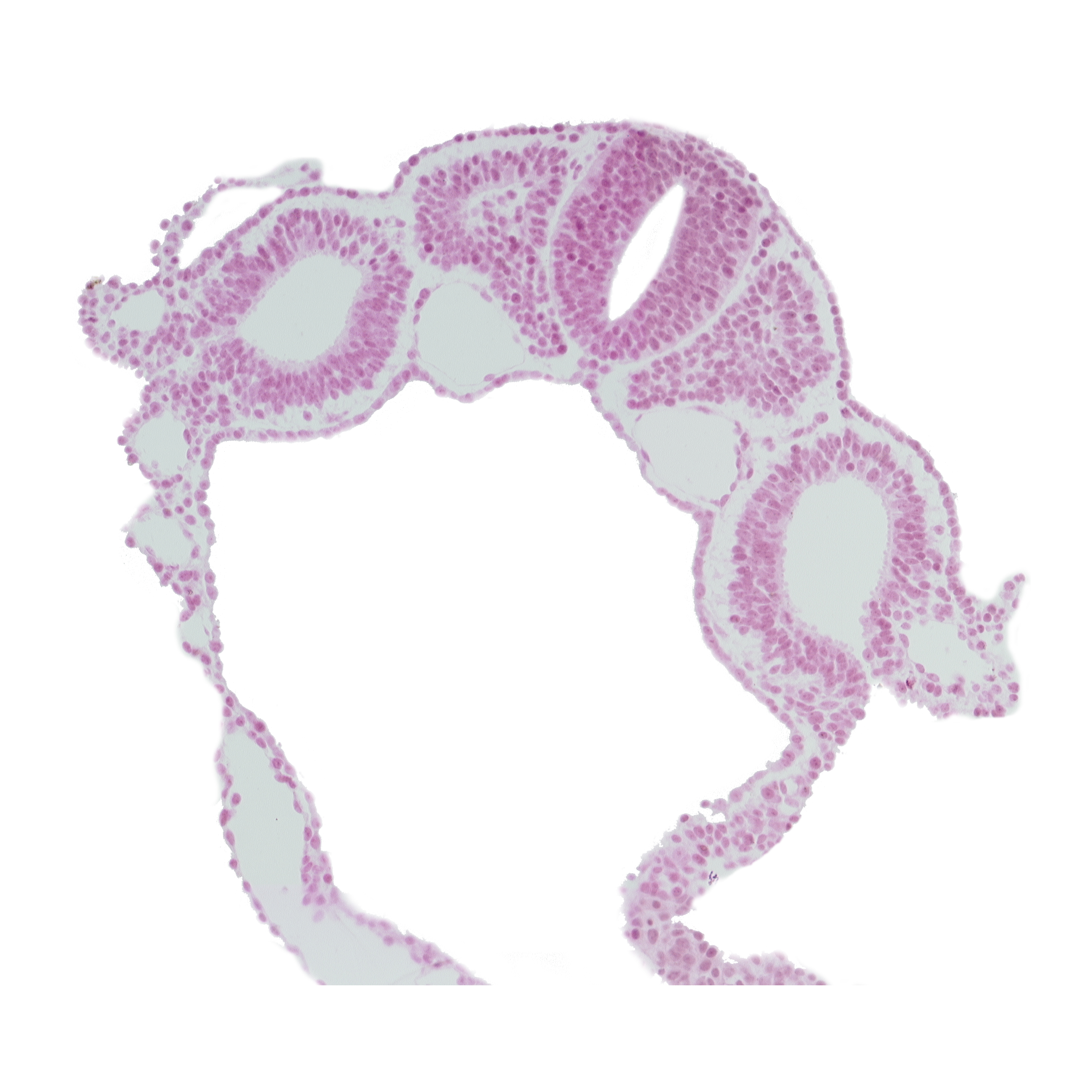 amnion attachment, communication between peritoneal cavity and extra-embryonic coelom, dermatomyotome 4 (O-4) , dorsal aorta, hypoglossal neural crest (CN XII), midgut, notochord, peritoneal cavity, rhombencephalon (Rh. D), right umbilical vein, right vitelline (omphalomesenteric) vein, umbilical vesicle wall