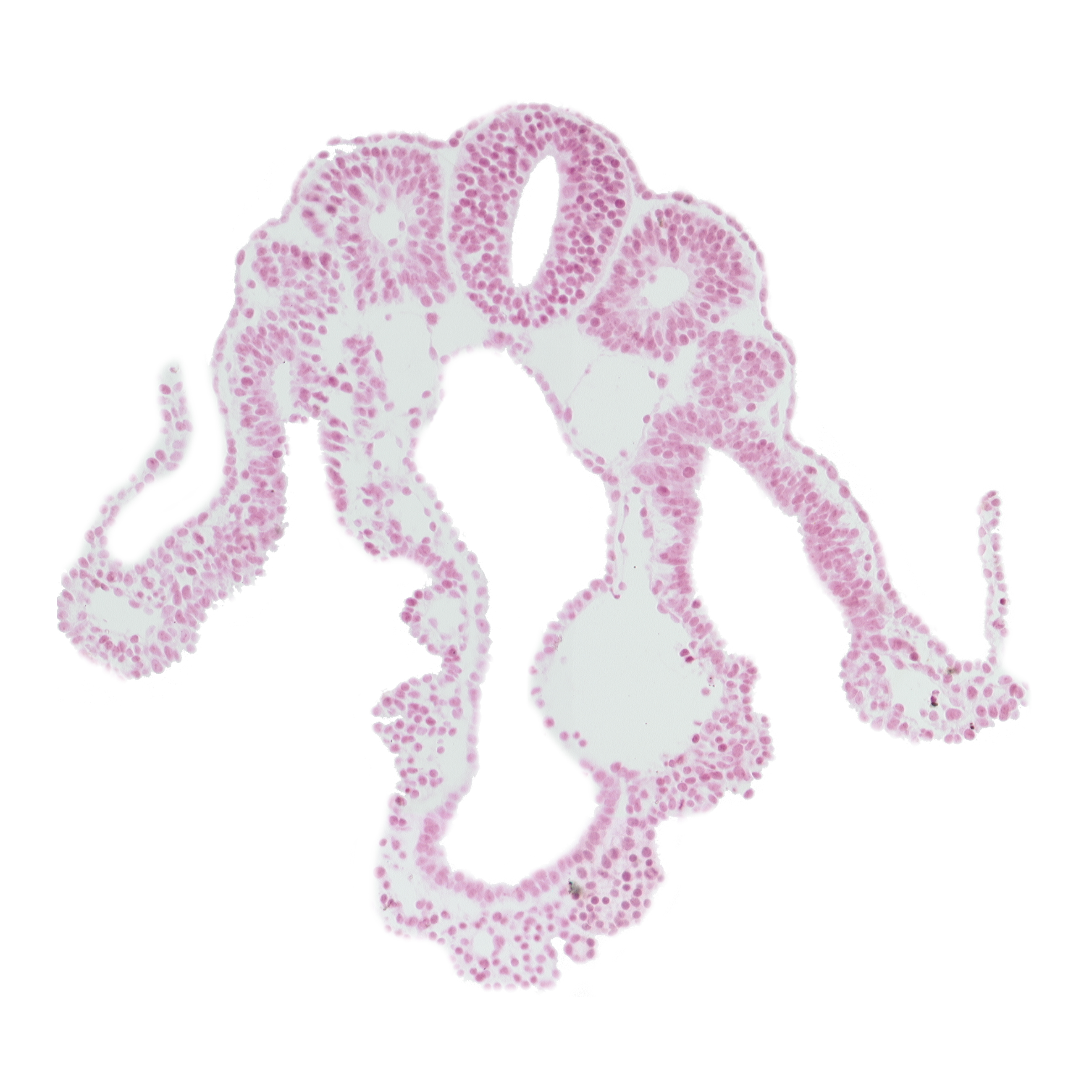 amnion attachment, midgut, somite 10 (C-6), somitocoel 10, spinal part of neural tube