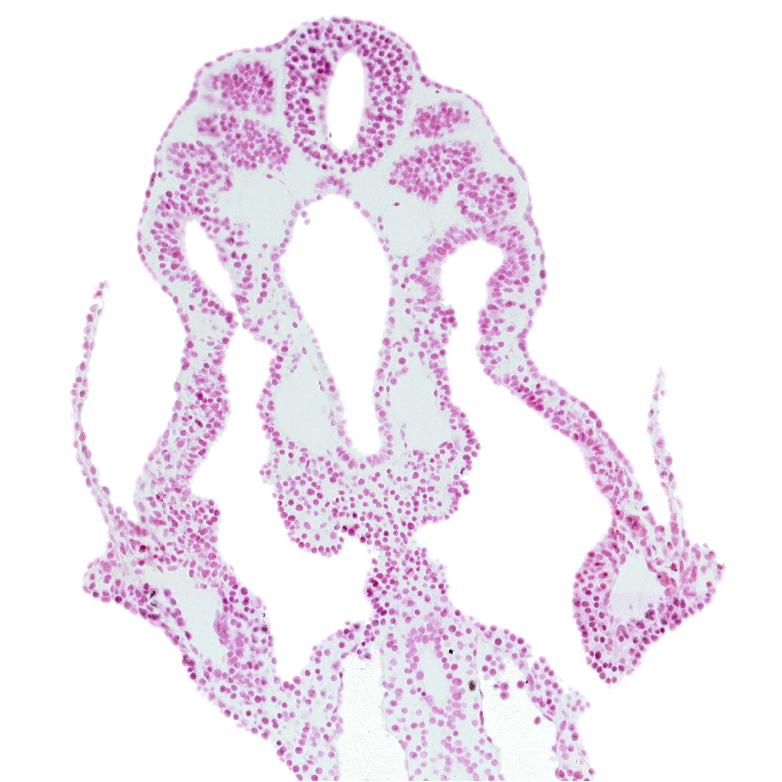 caudal intestinal portal, caudal part of somite 11 (C-7), cephalic part of somite 12 (C-8), continuity of allantois, endoderm, notochord, right umbilical vein