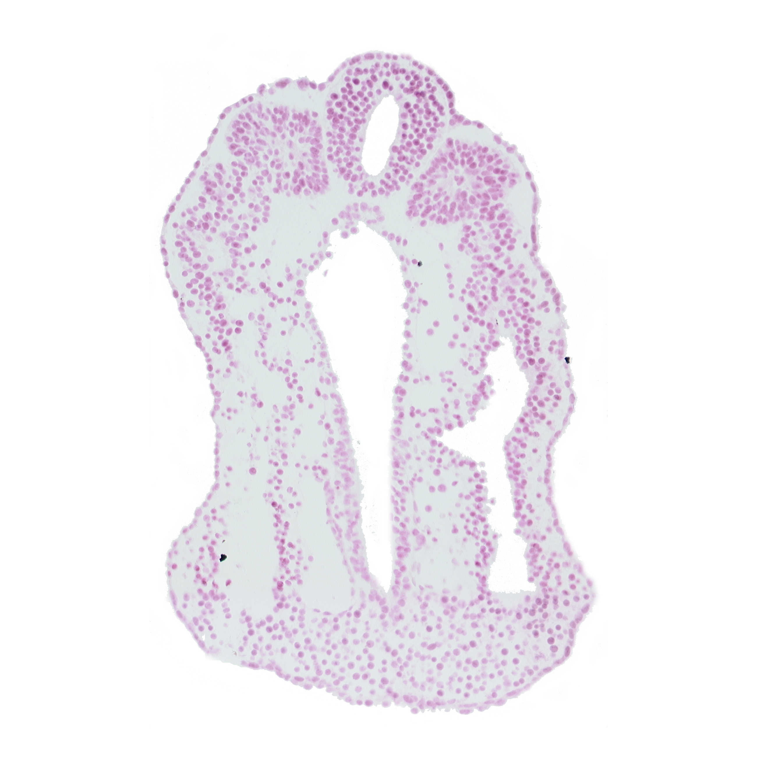 dorsal aorta, intermediate mesenchyme, neural tube, right umbilical artery, somite 13 (T-1), somitocoel 13
