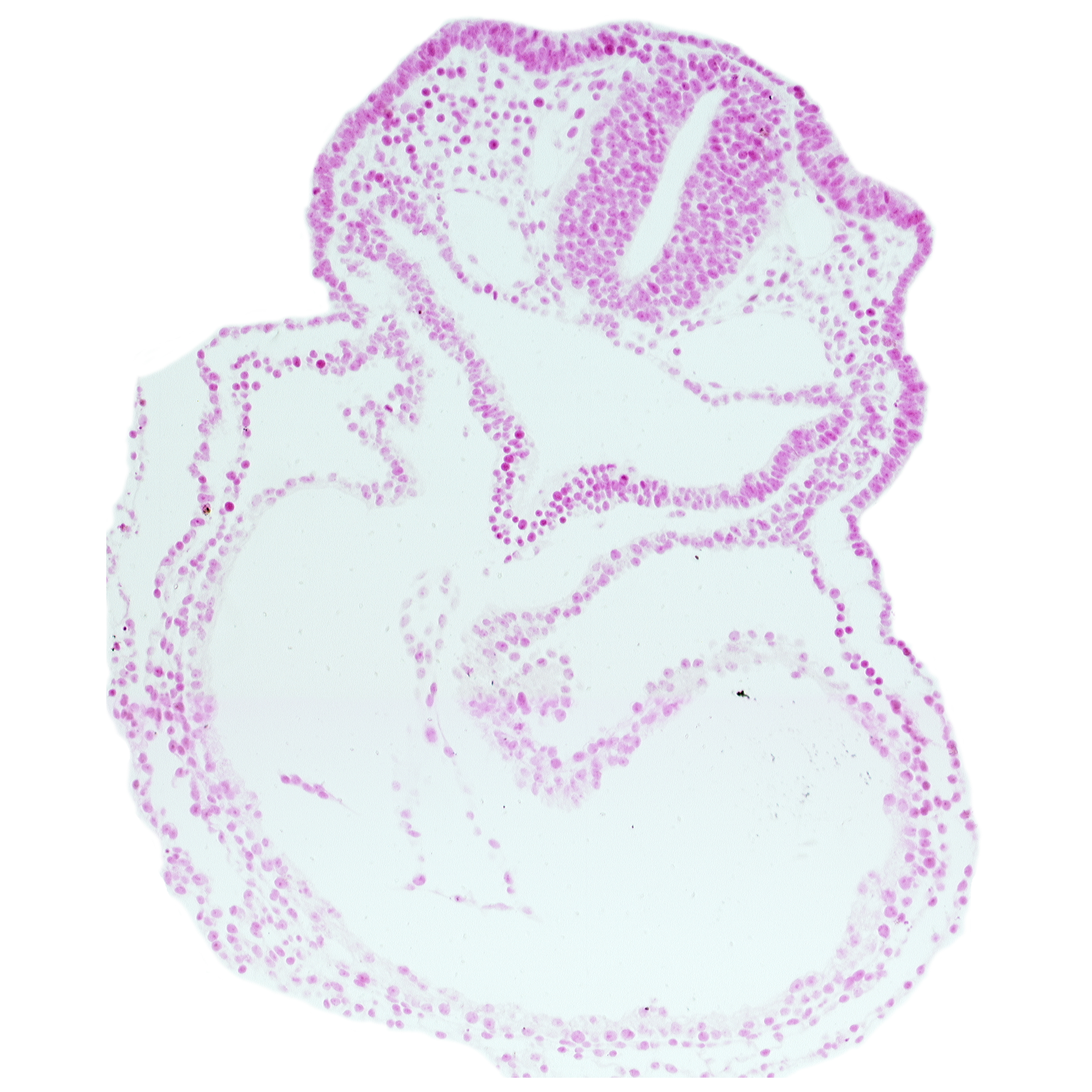 dorsal aorta, otic placode, pericardial cavity, primary head vein, right ventricle, thyroid diverticulum