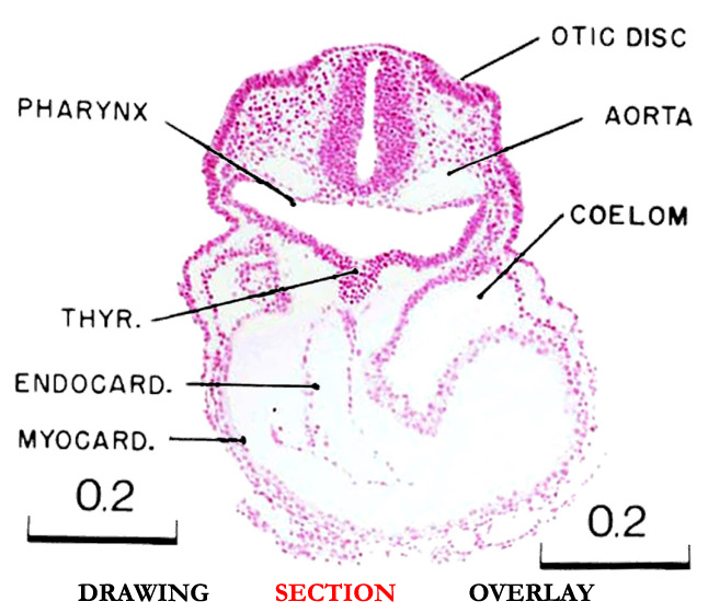 Slice A section