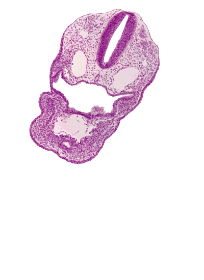 aortic sac, cephalic edge of pericardial sac, dermatomyotome 1 (O-1), dermatomyotome 2 (O-2) , dorsal aorta, ectodermal ring, perinotochordal lamina, pharyngeal arch 3, pharyngeal groove 1, pharyngeal groove 2, pharyngeal groove 3, pharyngeal pouch 3, precardinal vein